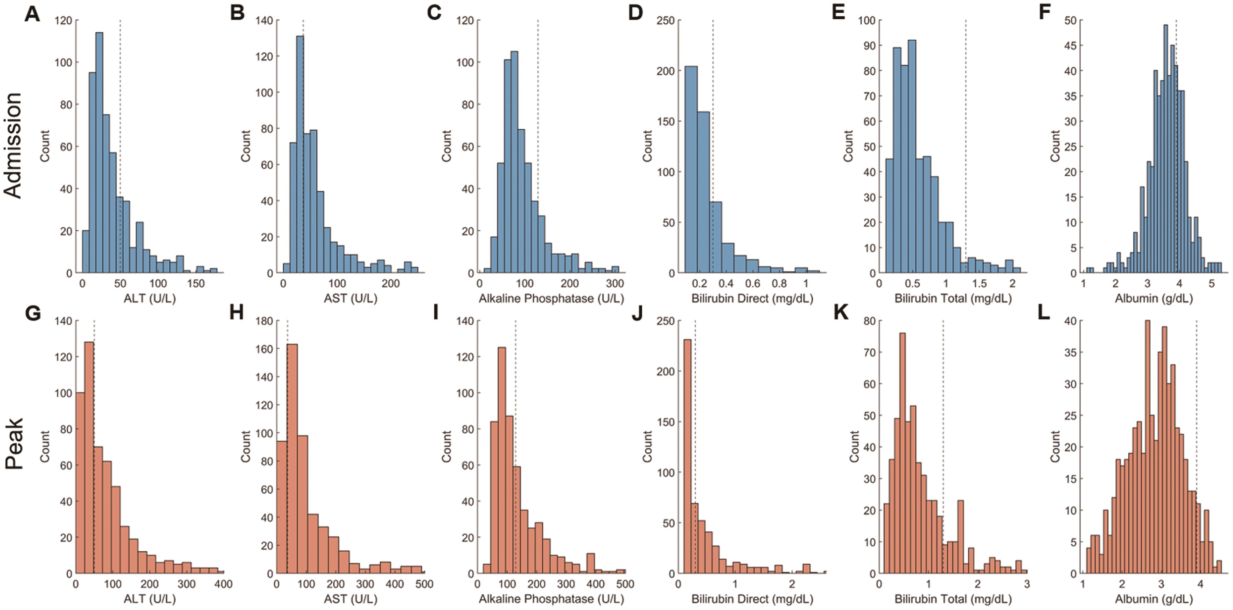 Histograms of admission and peak liver laboratory test results.
