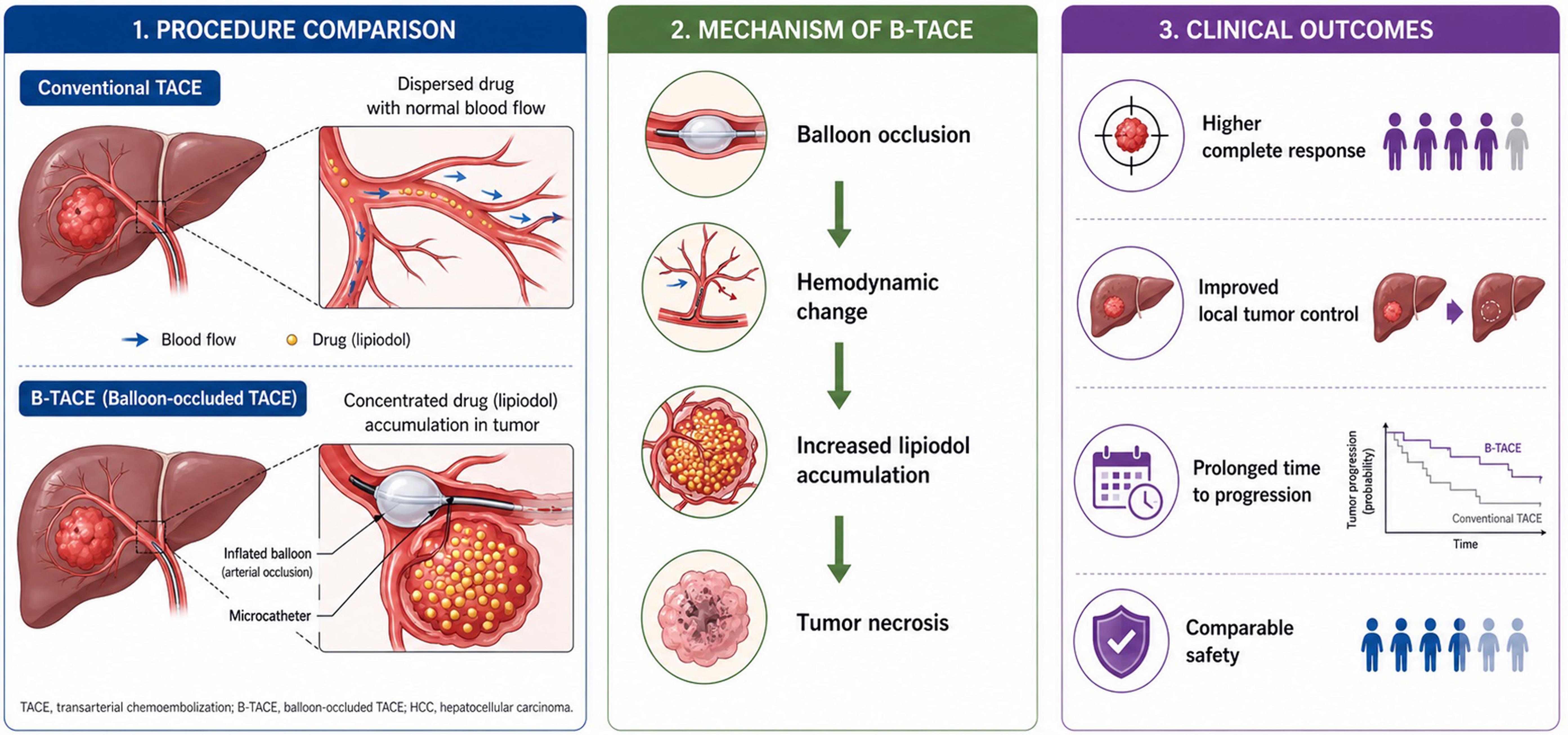 Mechanism of B-TACE.