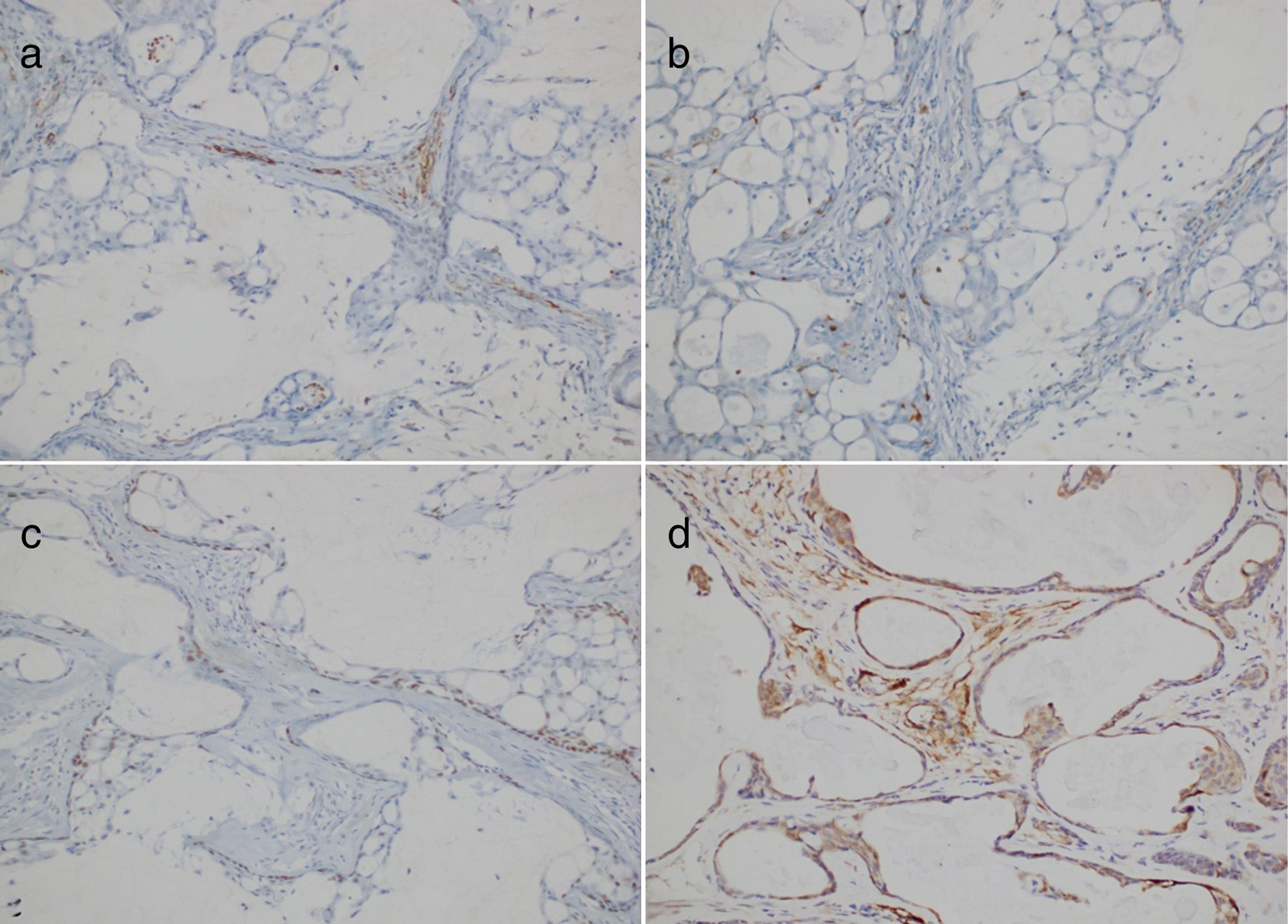 Immunohistochemical examination of parotidectomy material.