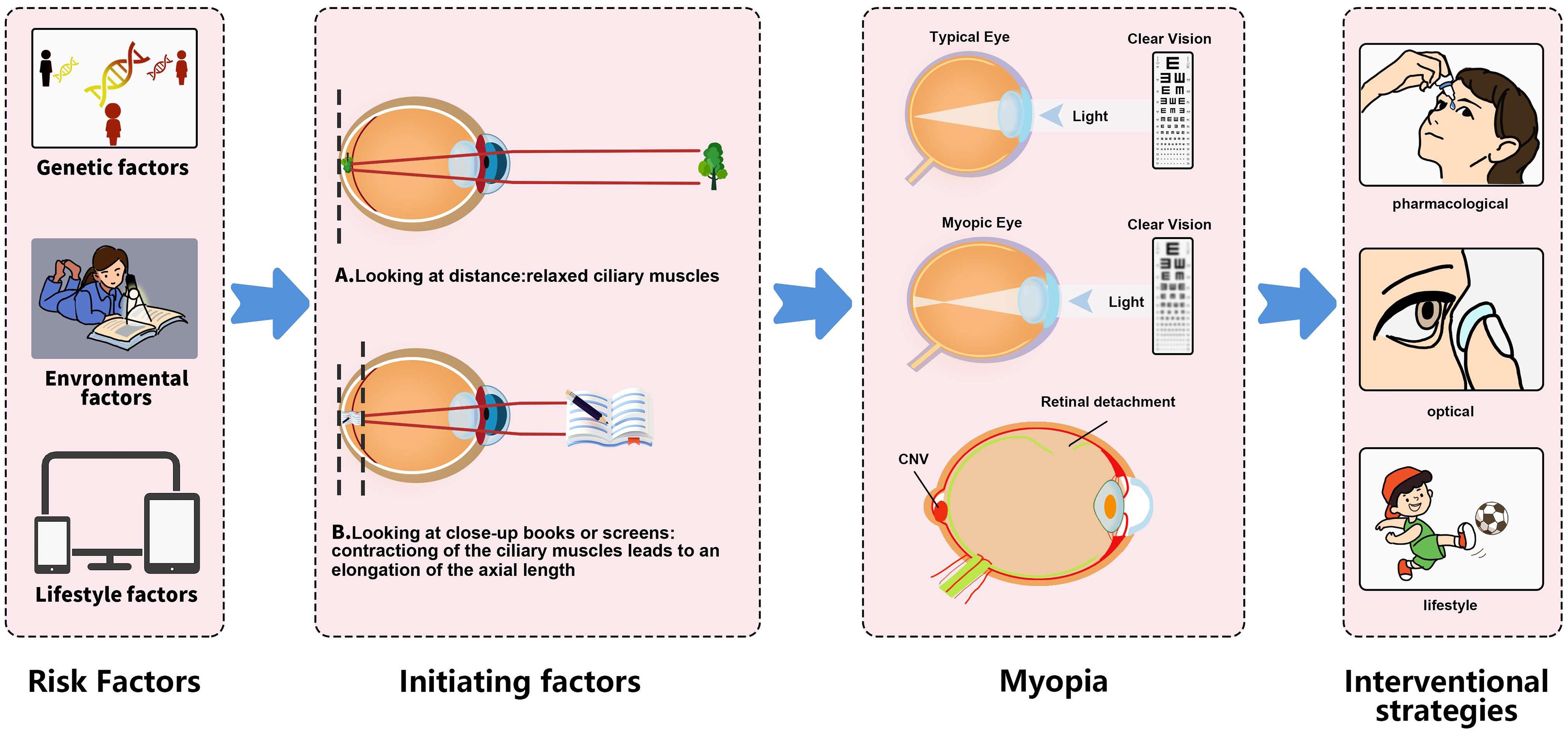 Initiating factors for myopia.
