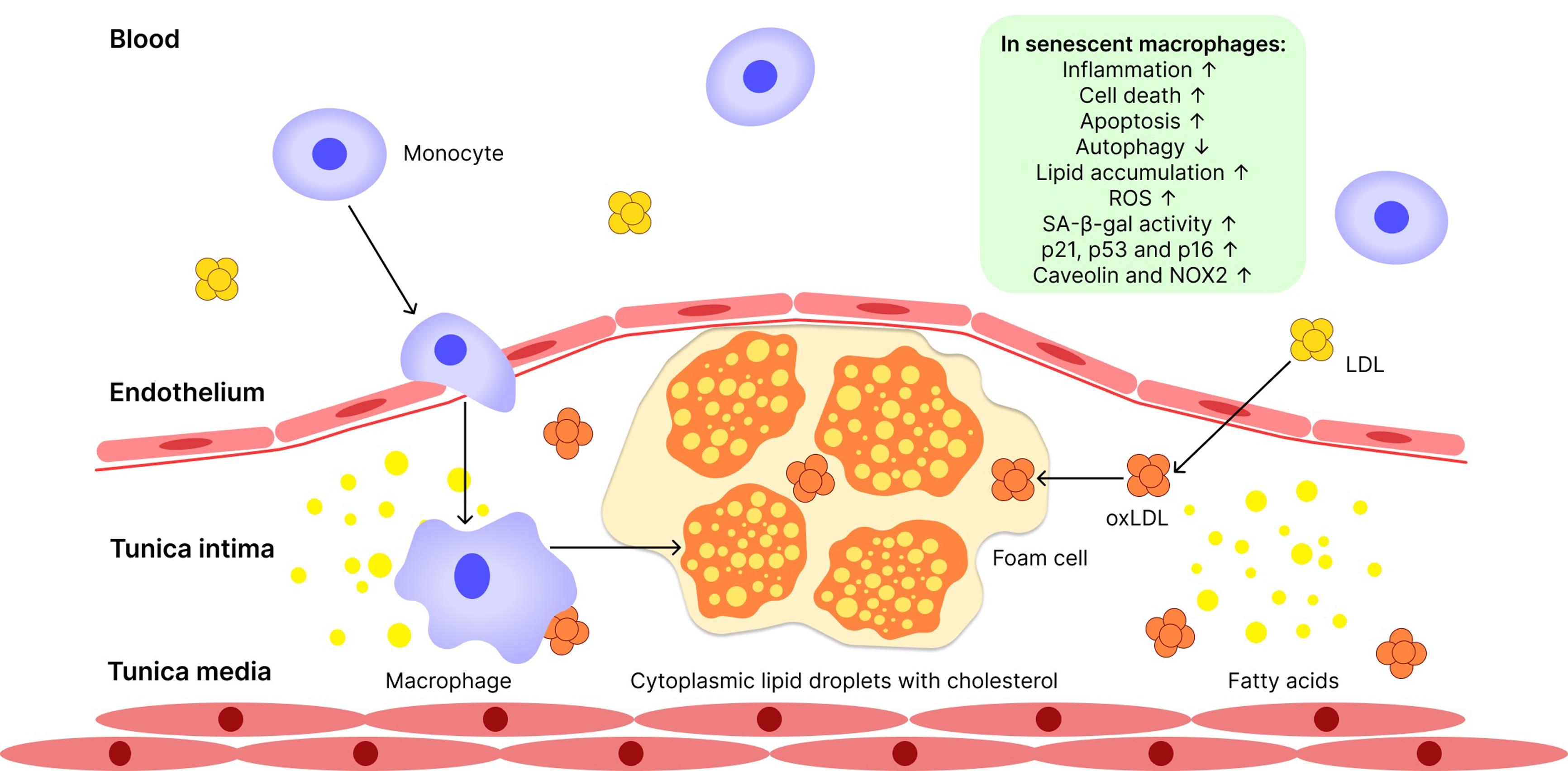 Senescence of macrophages.
