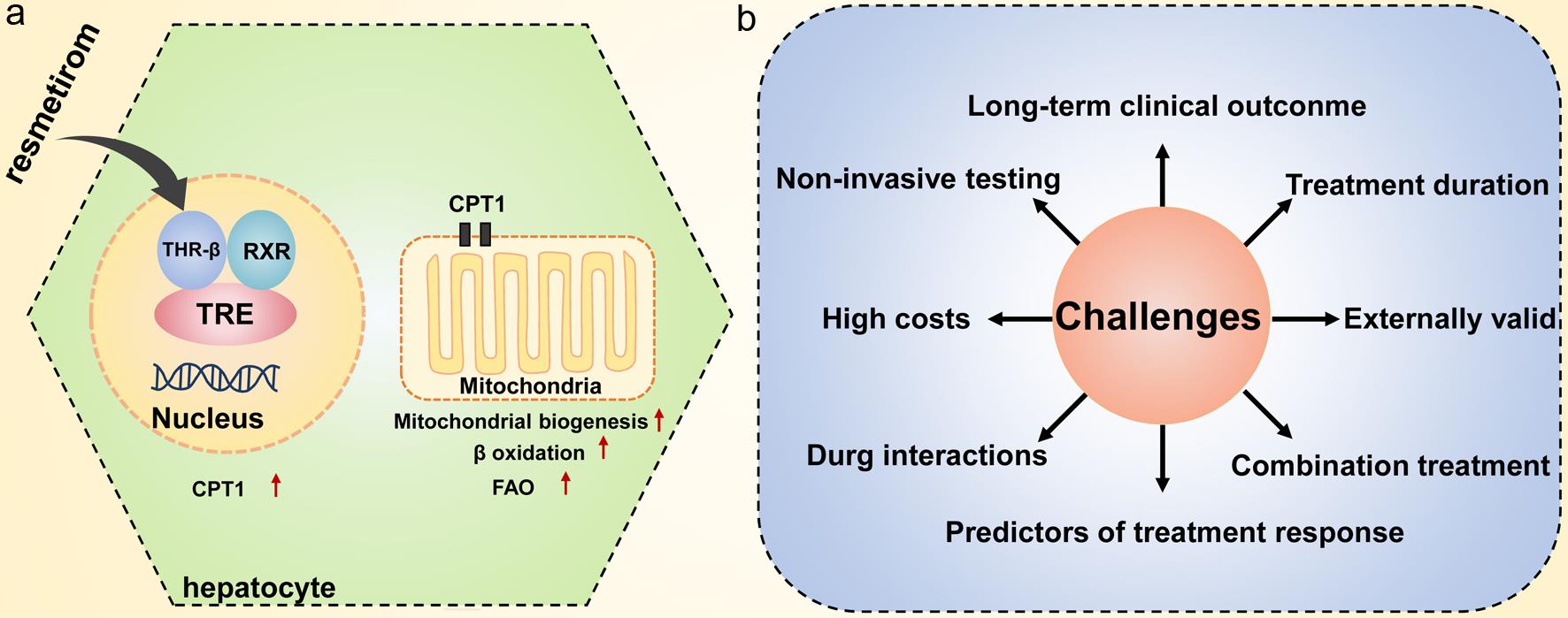 Resmetirom’s mechanisms in regulating hepatic lipid metabolism (a) and clinical challenges (b).