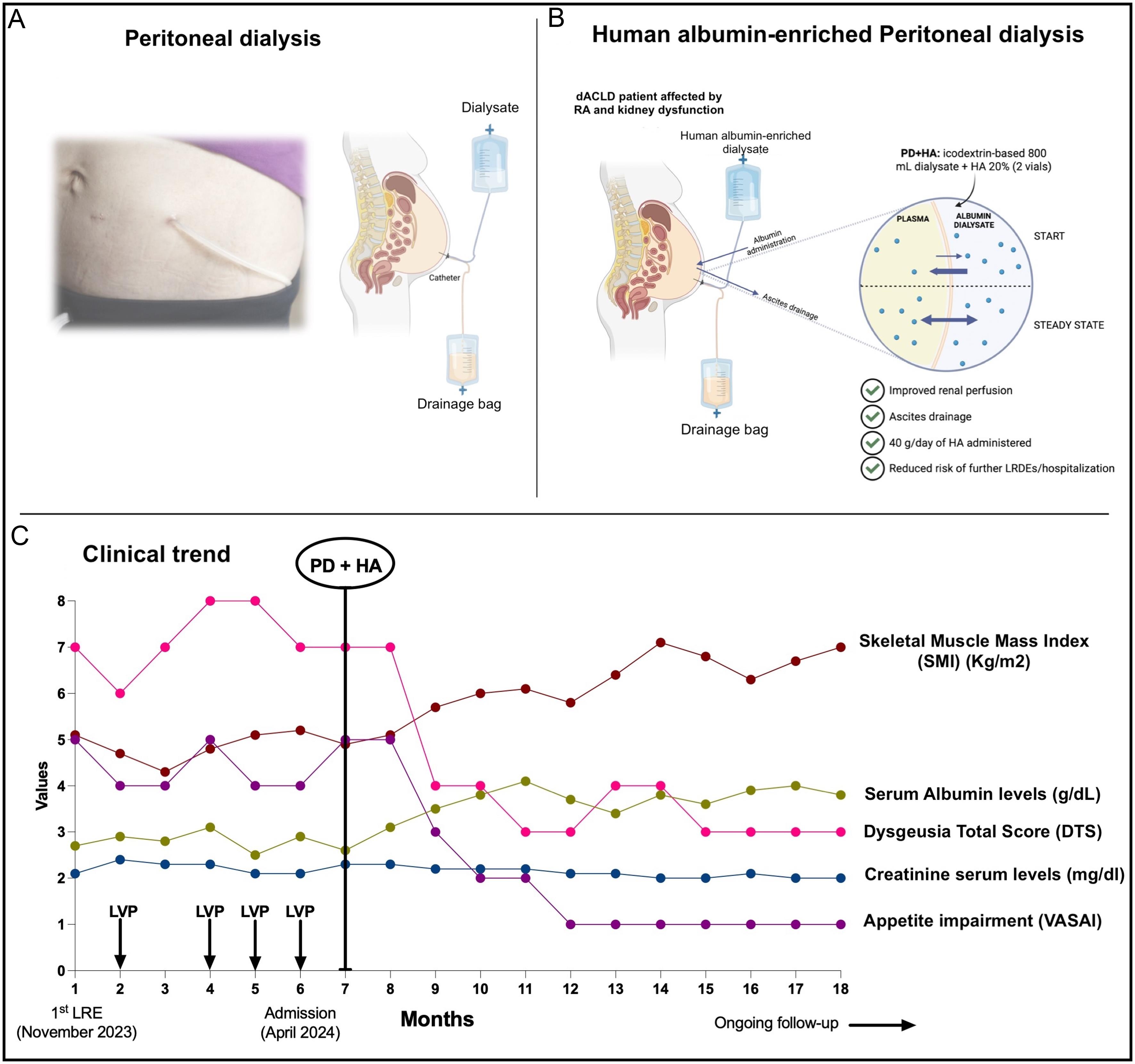 Peritoneal dialysis (PD) and human albumin-enriched PD.