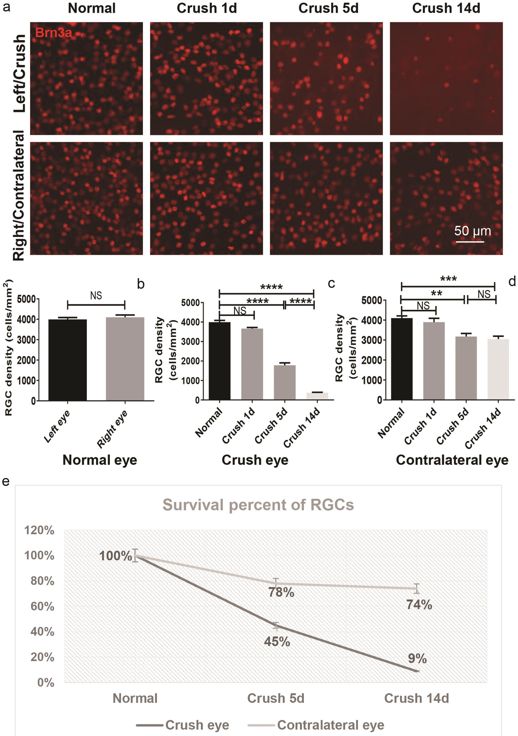Number of surviving RGCs was counted as Brn3a-positive cells in the healthy mice and ONC mice at different time-points post-ONC.