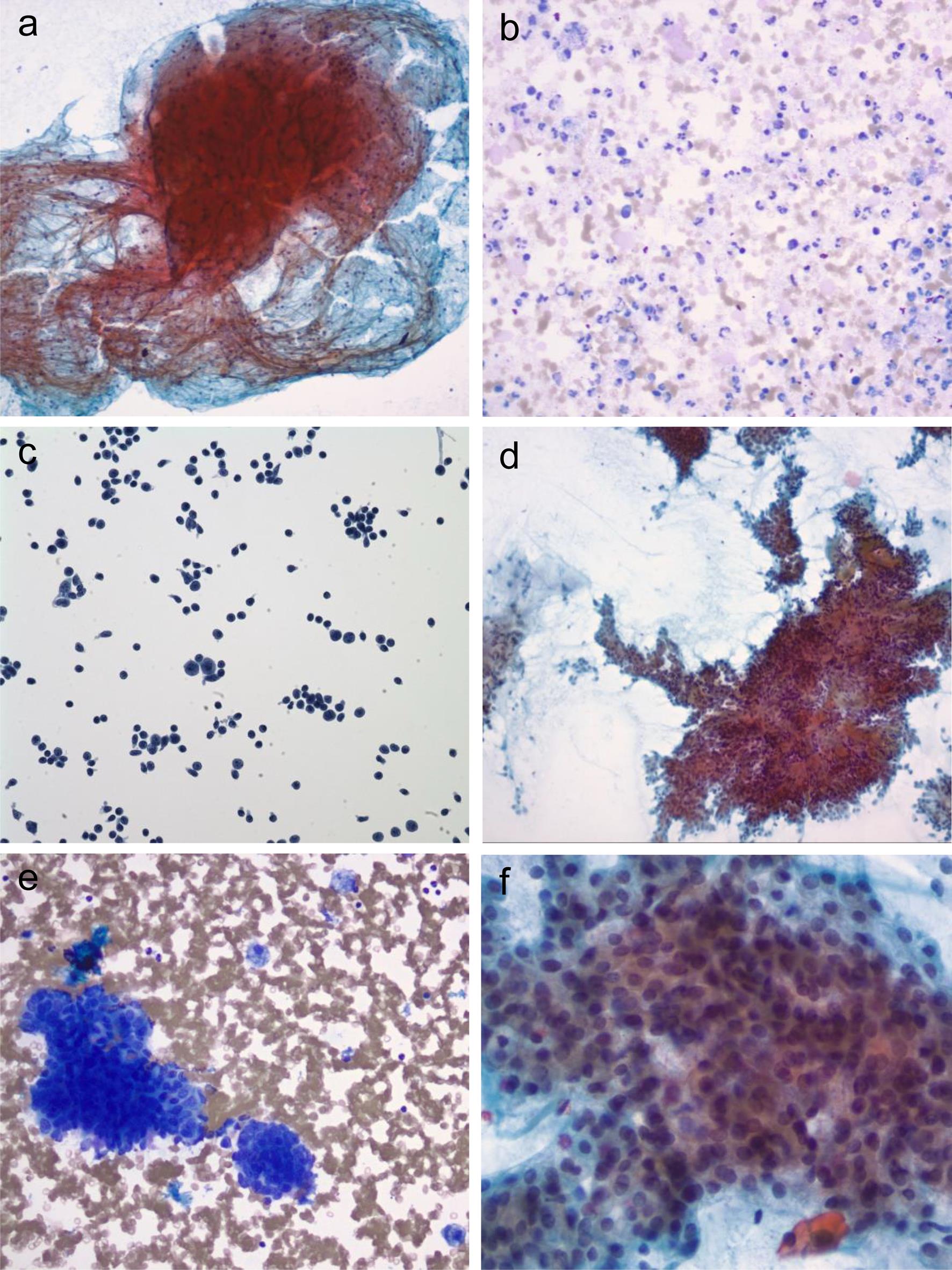 Representative examples in each diagnostic category of the MSRSGC.
