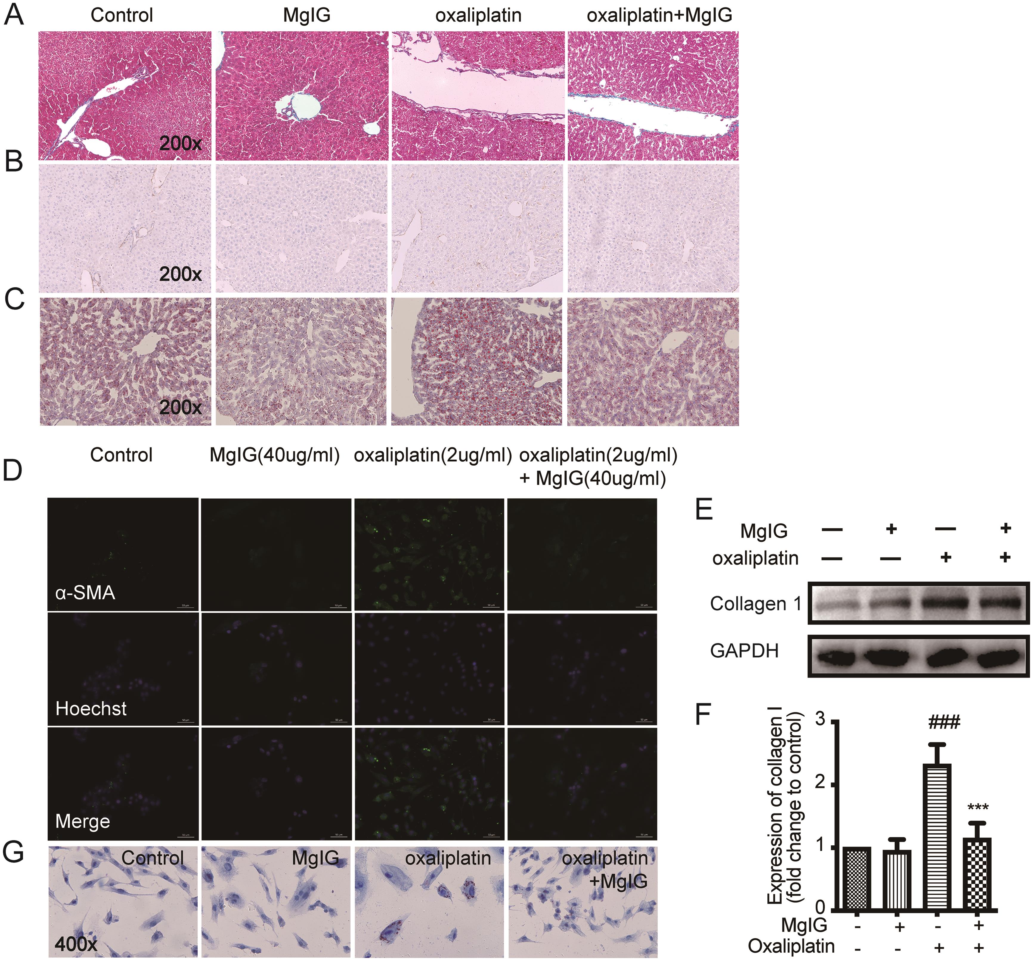 MgIG inhibited oxaliplatin-induced liver fibrosis and lipid deposition.