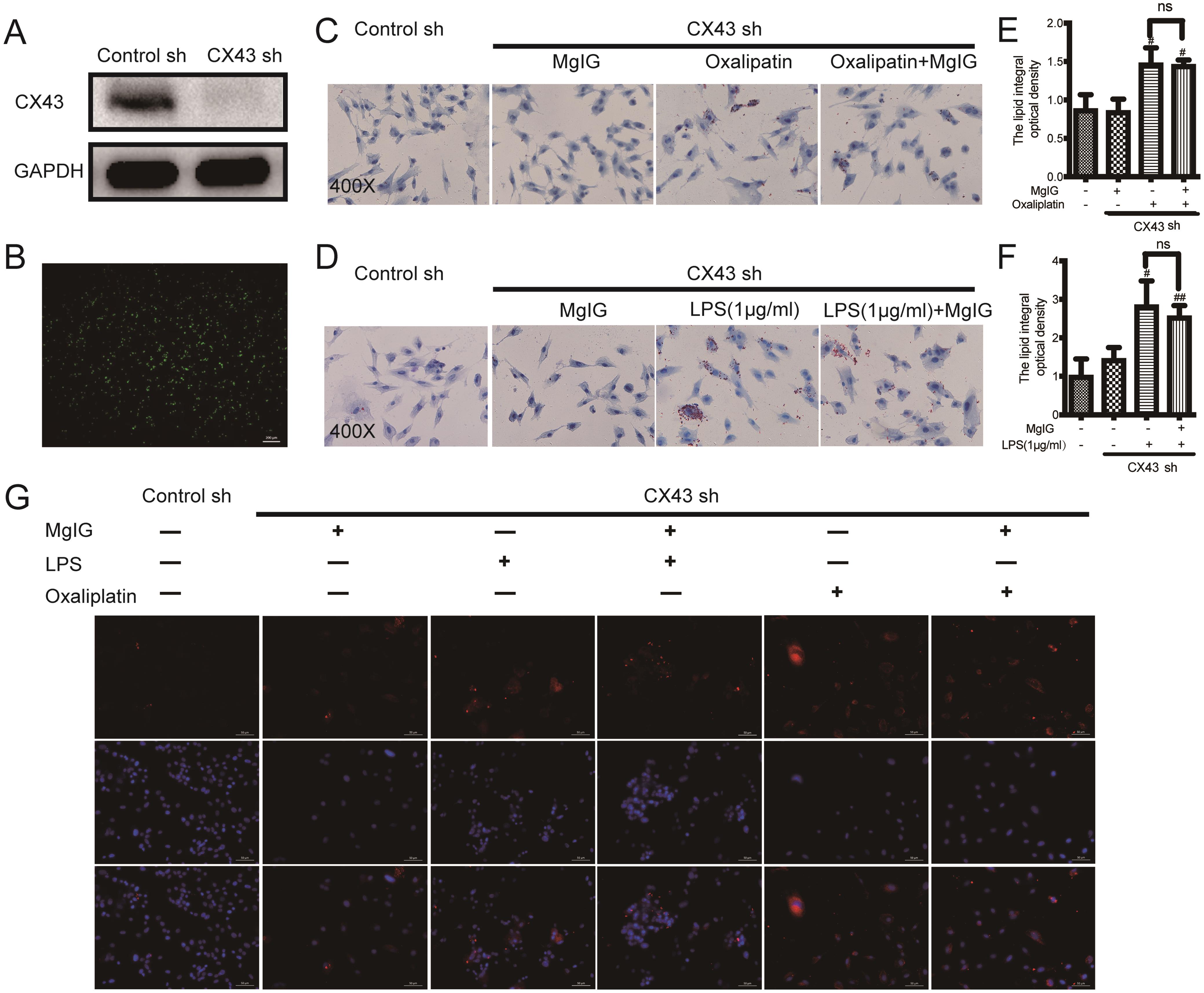 Effects of Cx43-knockdown on the protective effects of MgIG in oxaliplatin or LPS-induced LX-2 cells.