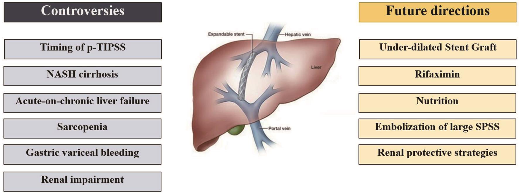 Pre-emptive TIPSS in Acute Variceal Bleeding: Current Status ...