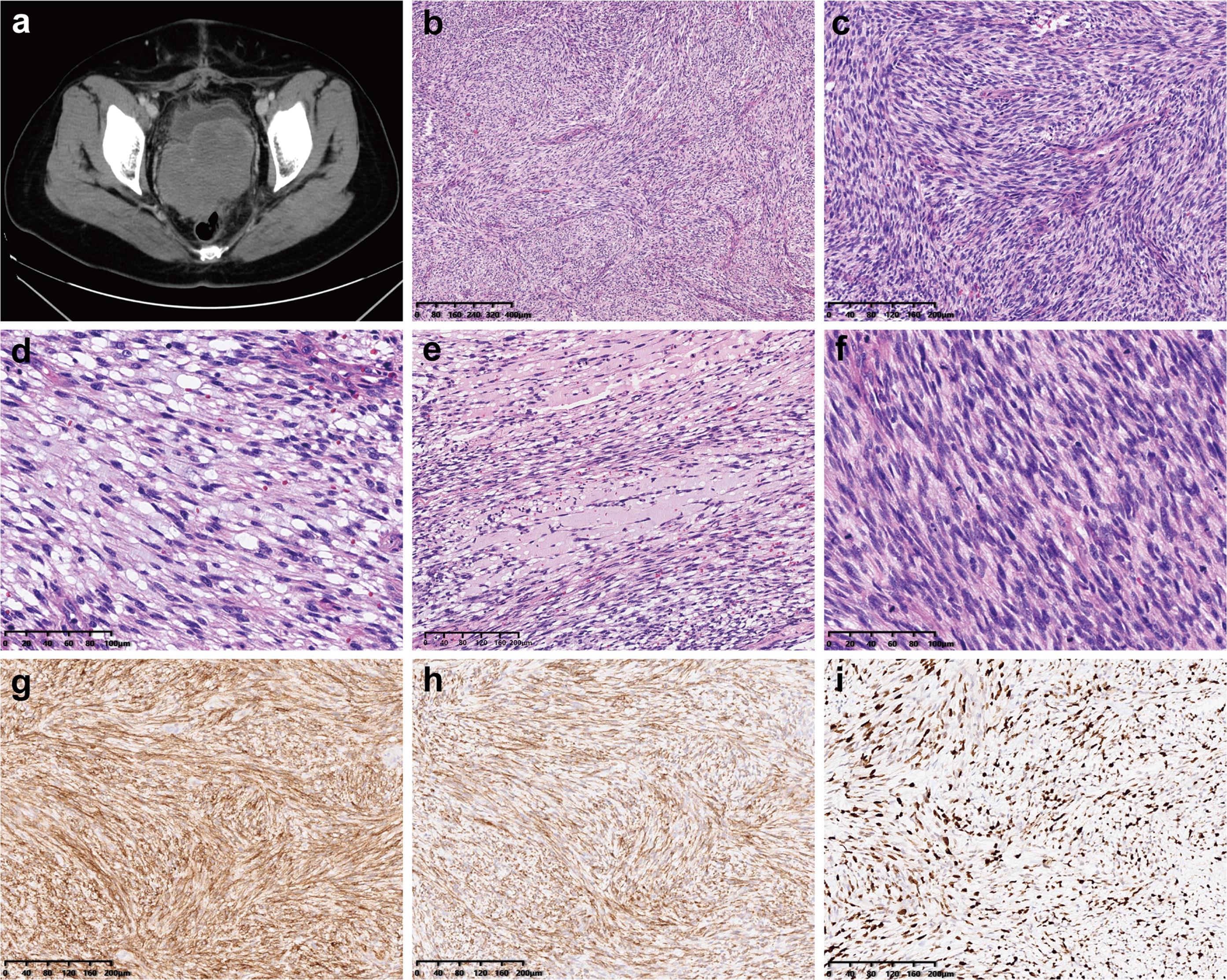 Radiological imaging and histopathological findings.