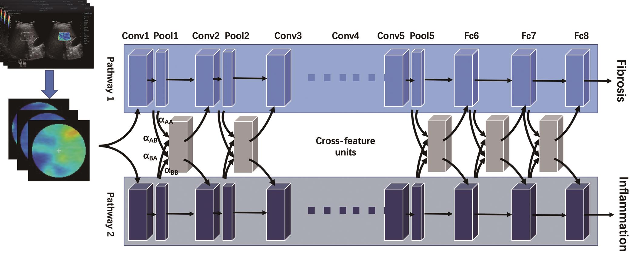 Illustration of the dual-task convolutional neural network (DtCNN) model for liver fibrosis and inflammation staging.