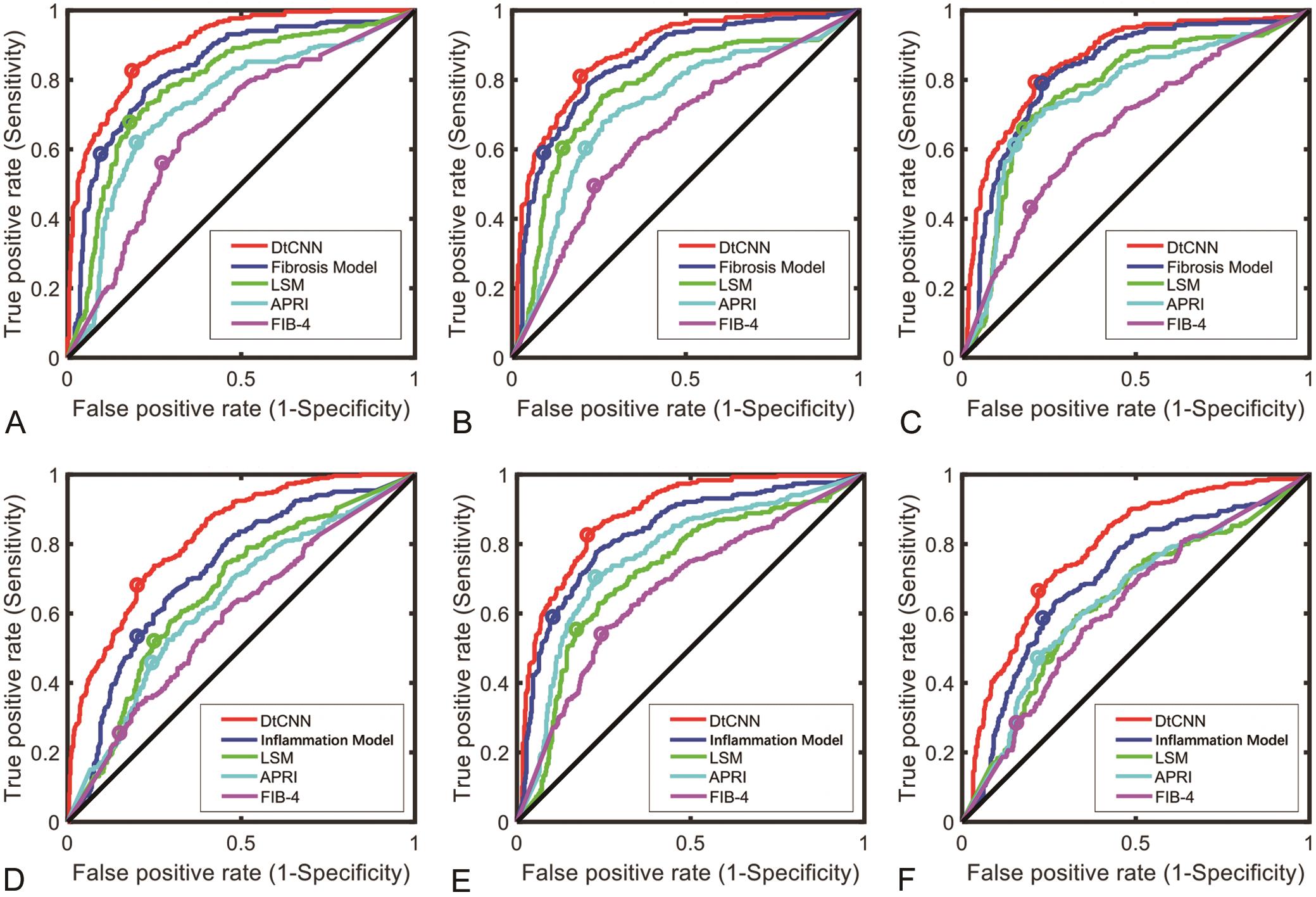 Comparison of the receiver operating characteristic (ROC) curves of the dual-task convolutional neural network (DtCNN); fibrosis model; inflammation model; LSM; APRI and FIB-4 for the assessment of (A) significant fibrosis (≥F2); (B) advanced fibrosis (≥F3); (C) cirrhosis (F4); (D) ≥A1; (E) ≥A2; and (F) A3 inflammation using retrospective data.