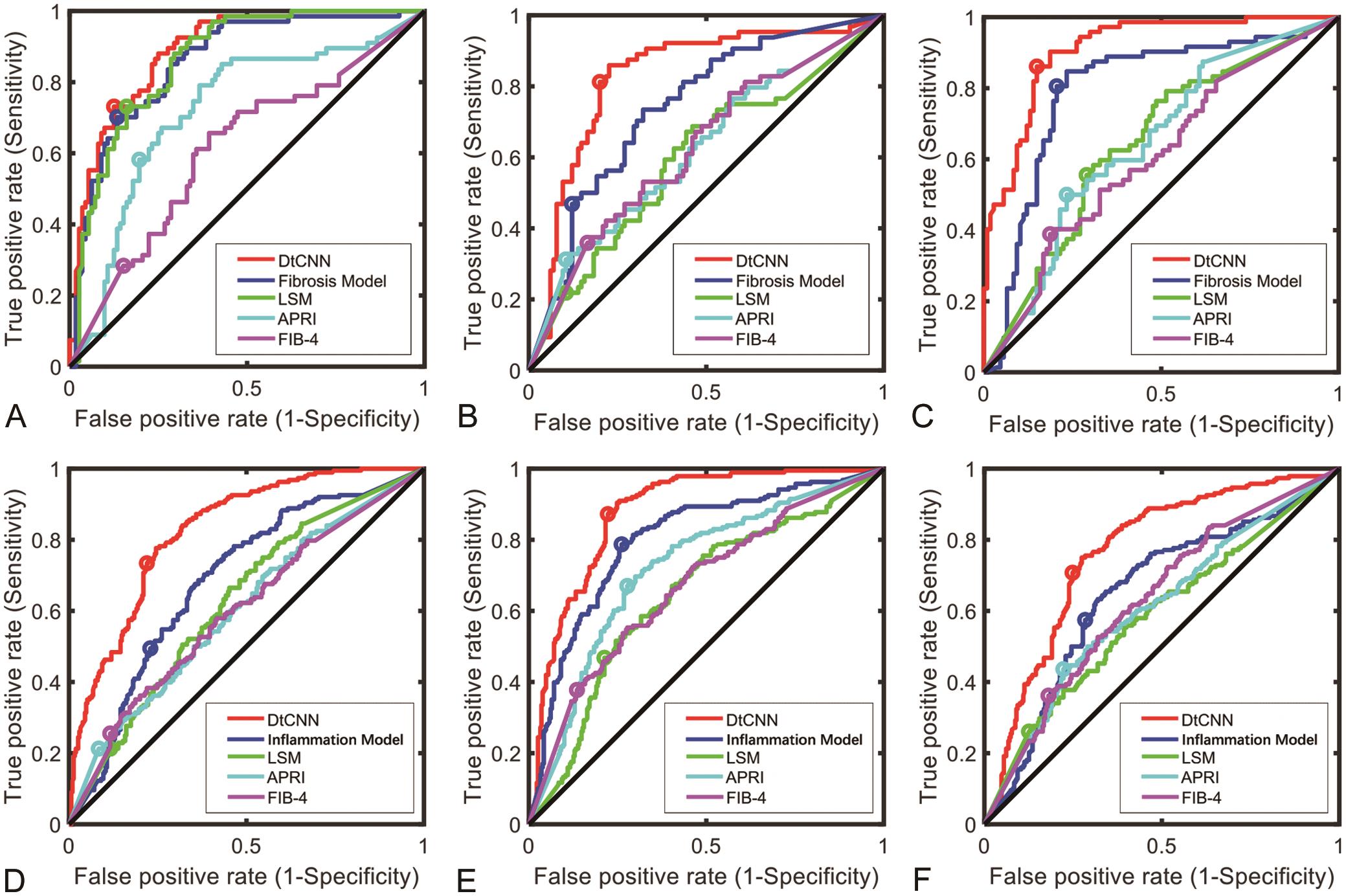 Comparison of receiver operating characteristic (ROC) curves of dual-task convolutional neural network (DtCNN); fibrosis model; inflammation model; LSM; APRI and FIB-4 for the assessment of (A) significant fibrosis (≥F2); (B) advanced fibrosis (≥F3) and (C) cirrhosis (F4); and (D) ≥A1; (E) ≥A2 and (F) A3 inflammation using prospective data.