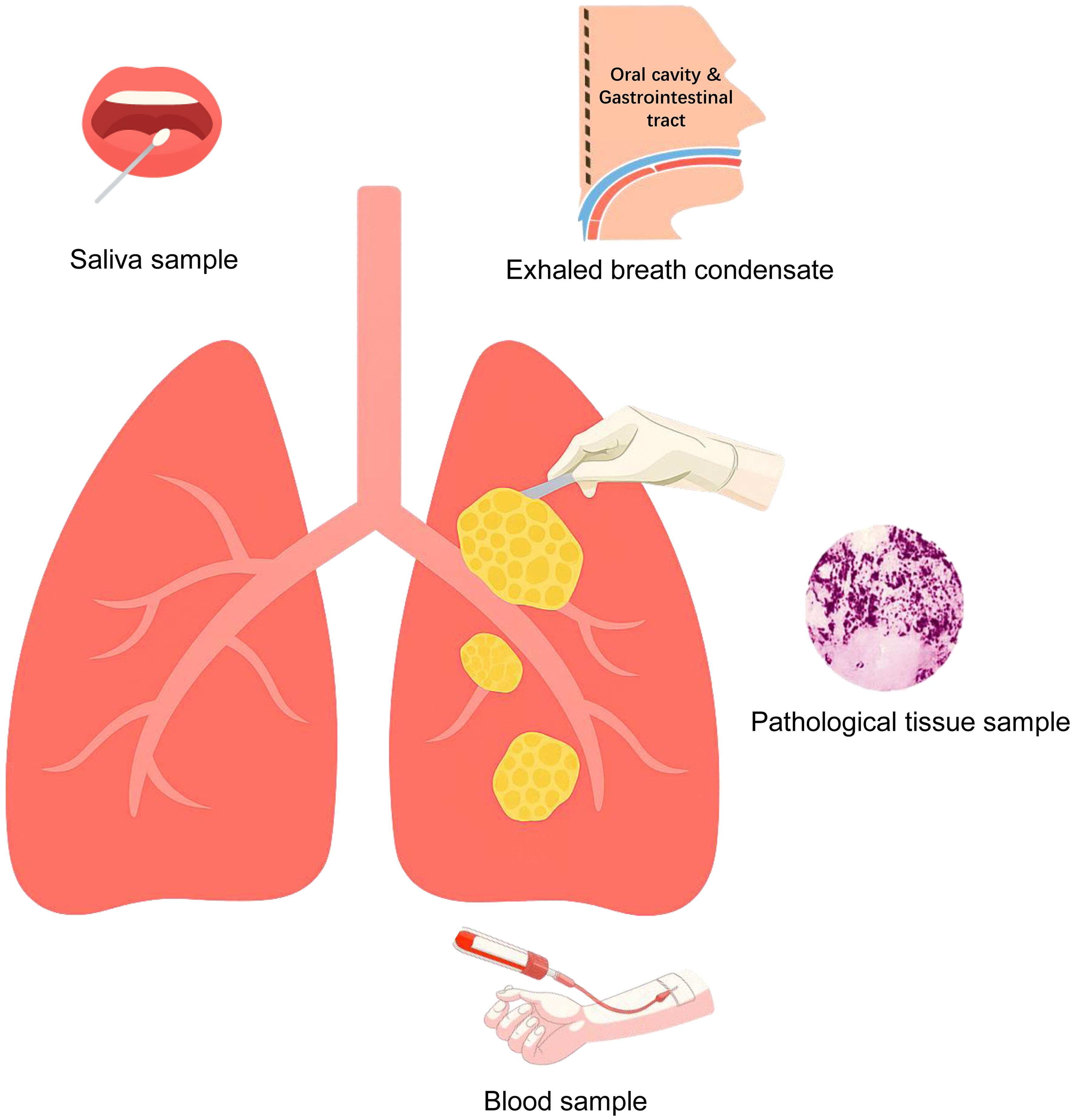 The anatomical origins and collection sites of the biological samples reviewed in this article, such as saliva, blood, exhaled breath condensate, and tissue samples.
