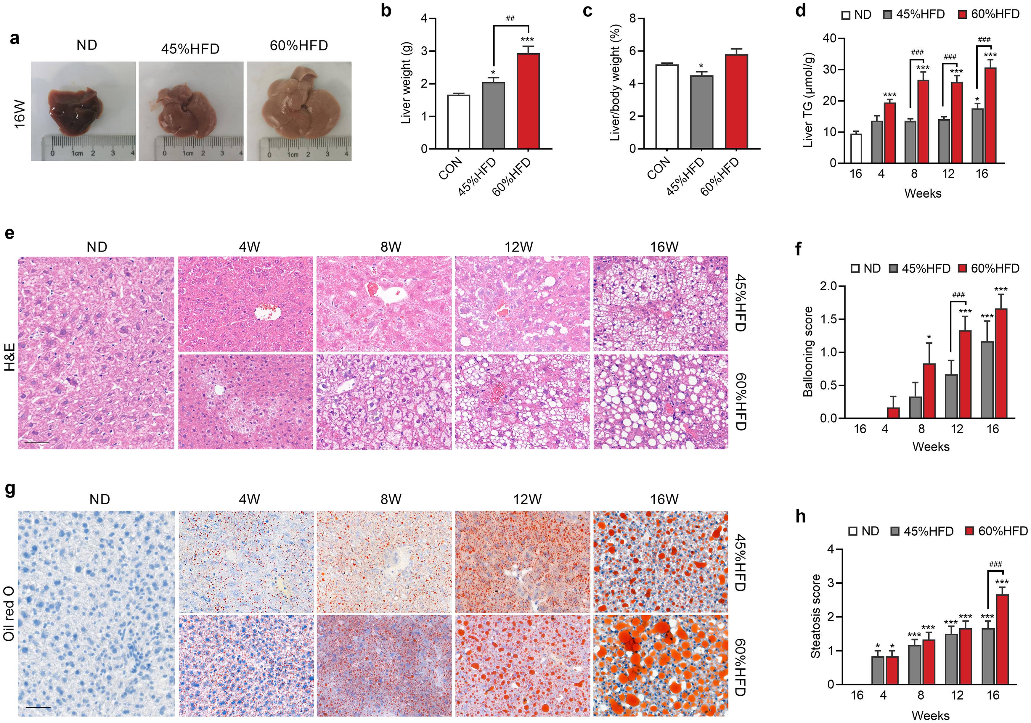 Effects of different HFDs on hepatic lipid accumulation.