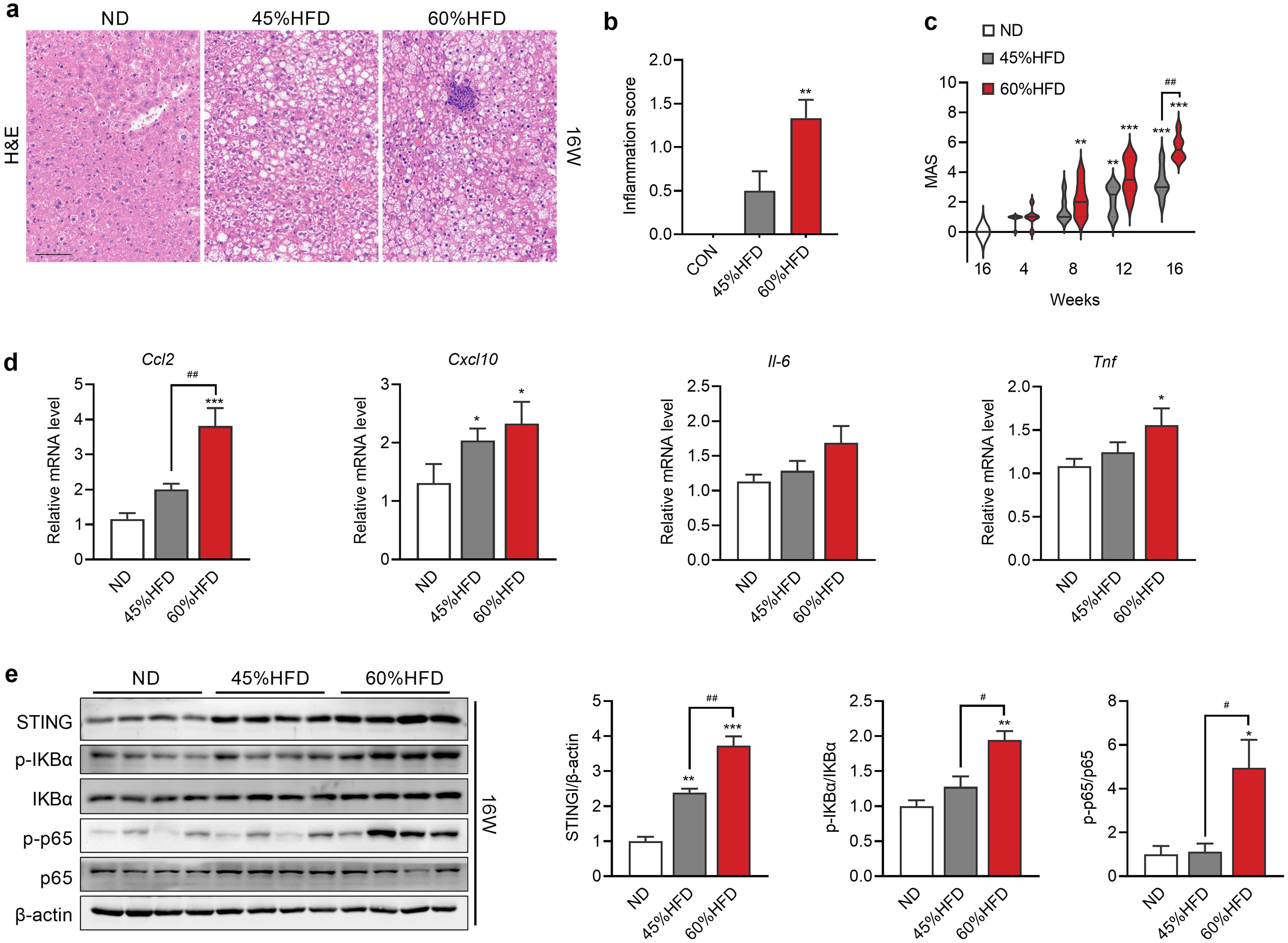 Effects of different HFDs on liver inflammation.