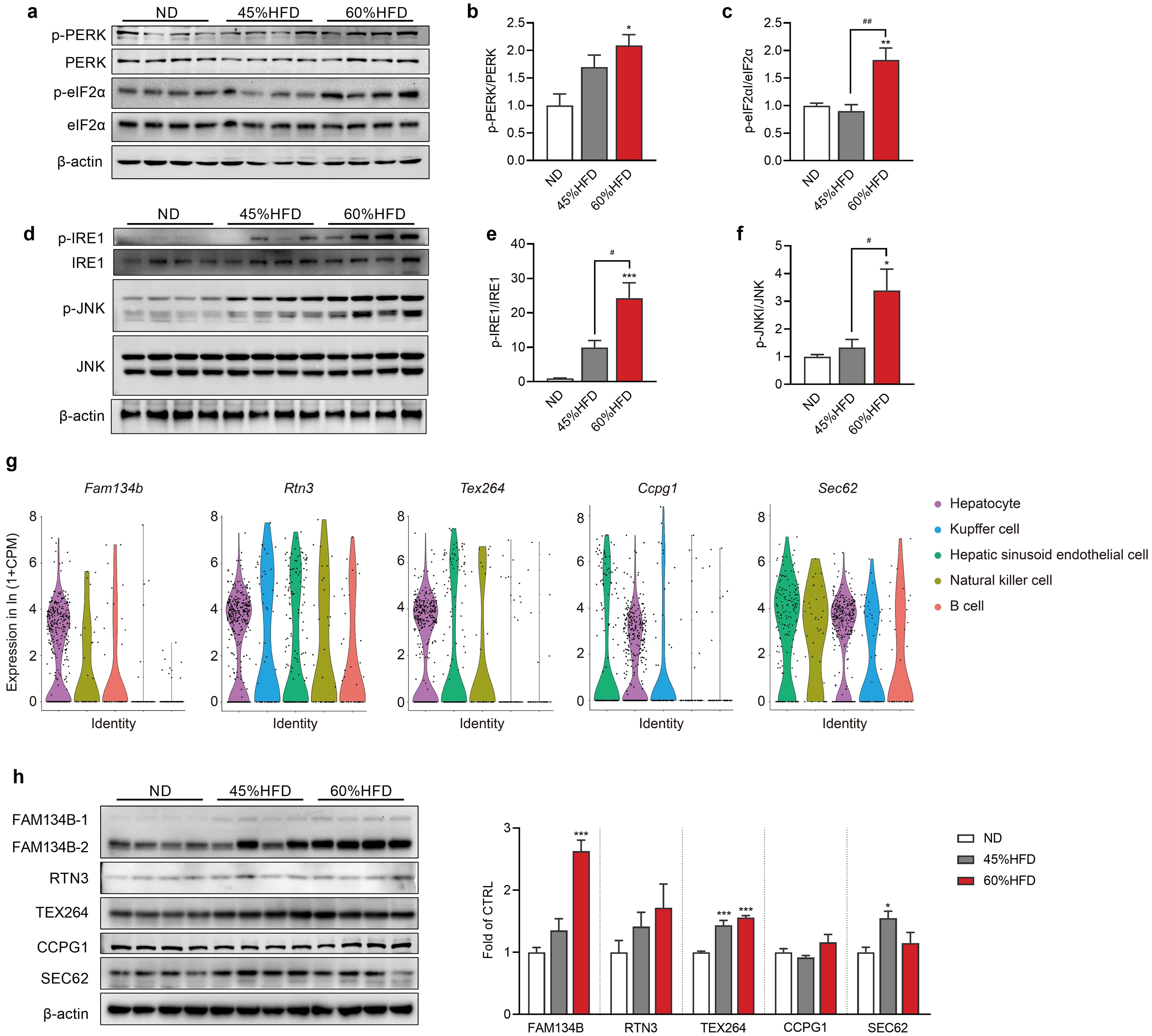 Effects of different HFDs on ER stress and ER-phagy.