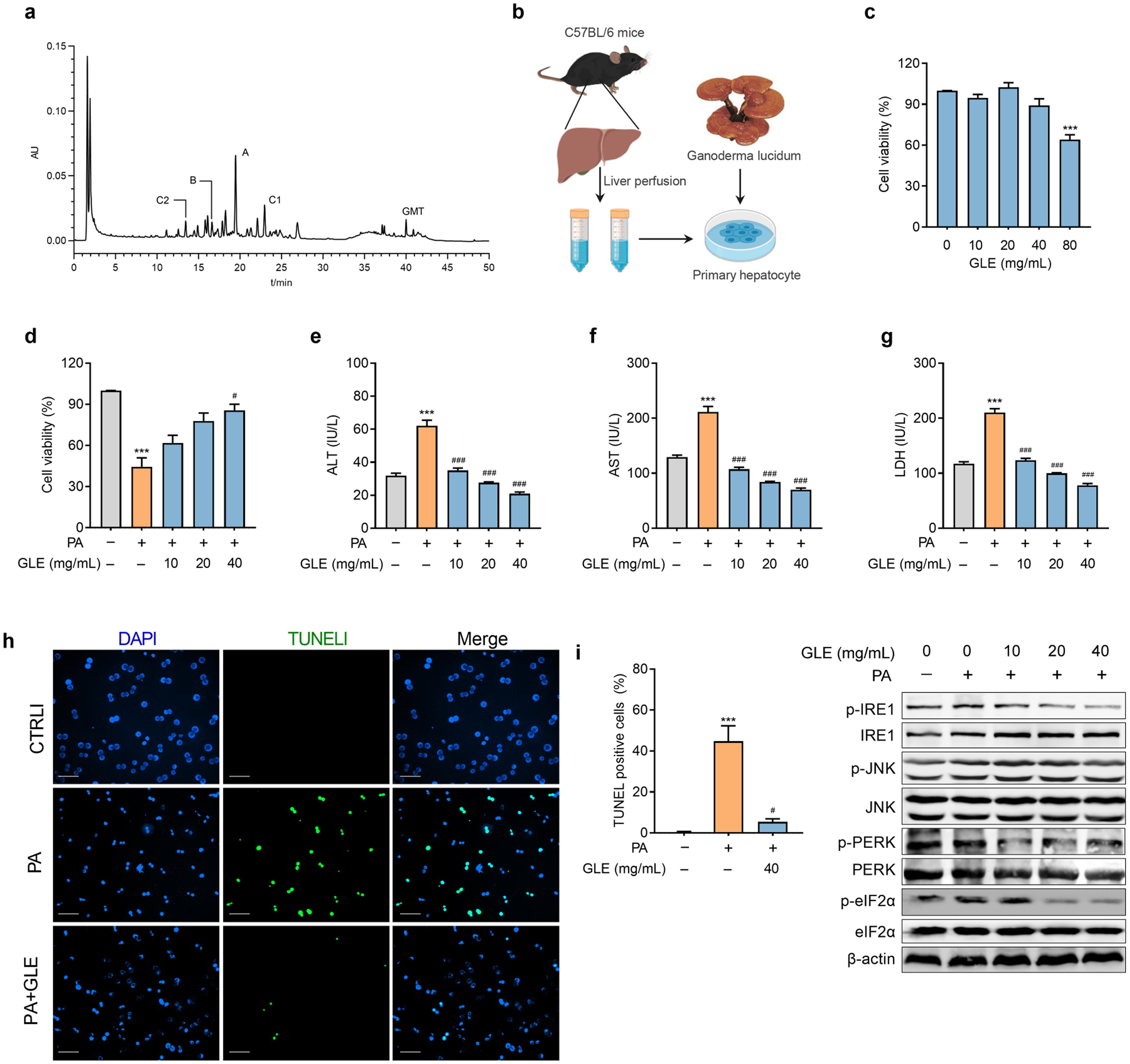 GLE reduces PA-induced lipotoxicity in primary hepatocytes.