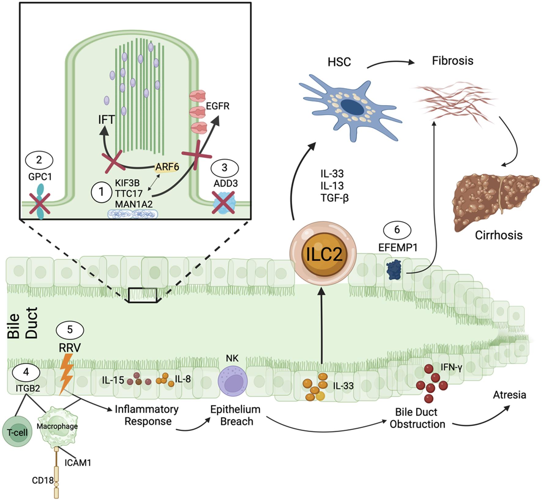 Effects of specific mutations involved in the development of biliary atresia.