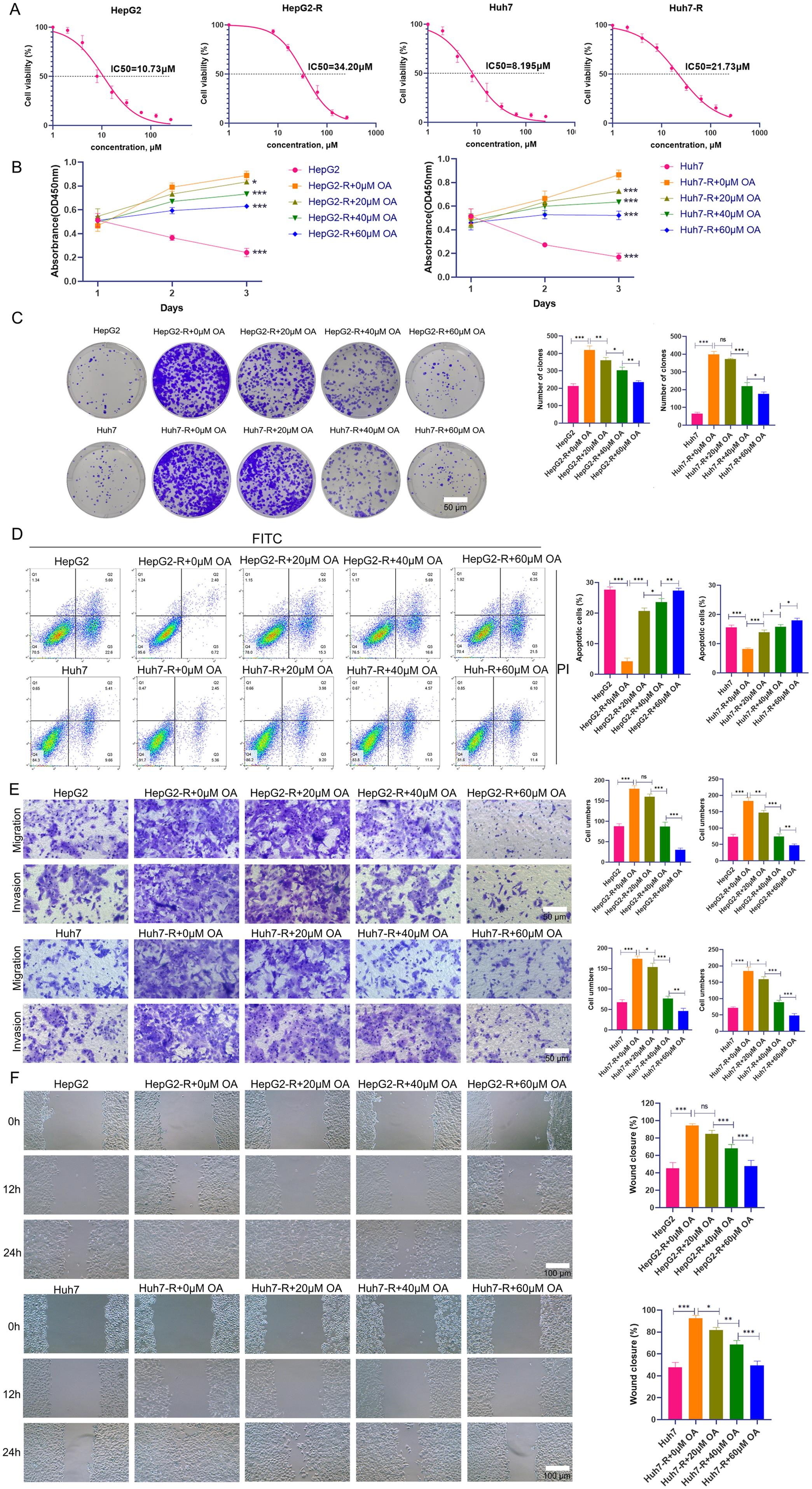 The effect of OA on the sensitivity of sorafenib-resistant HCC.