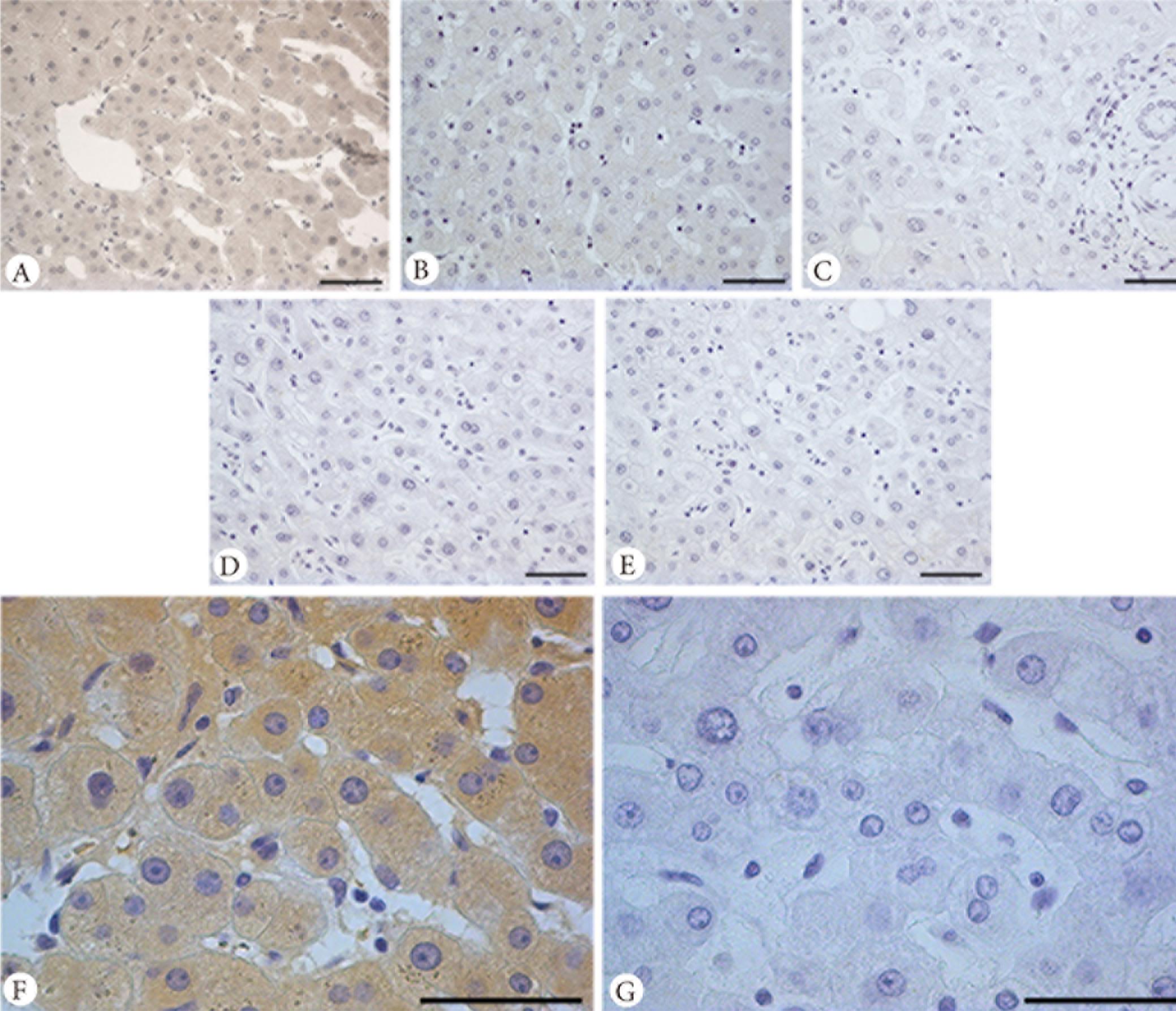 Immunohistochemical staining of liver tissue.