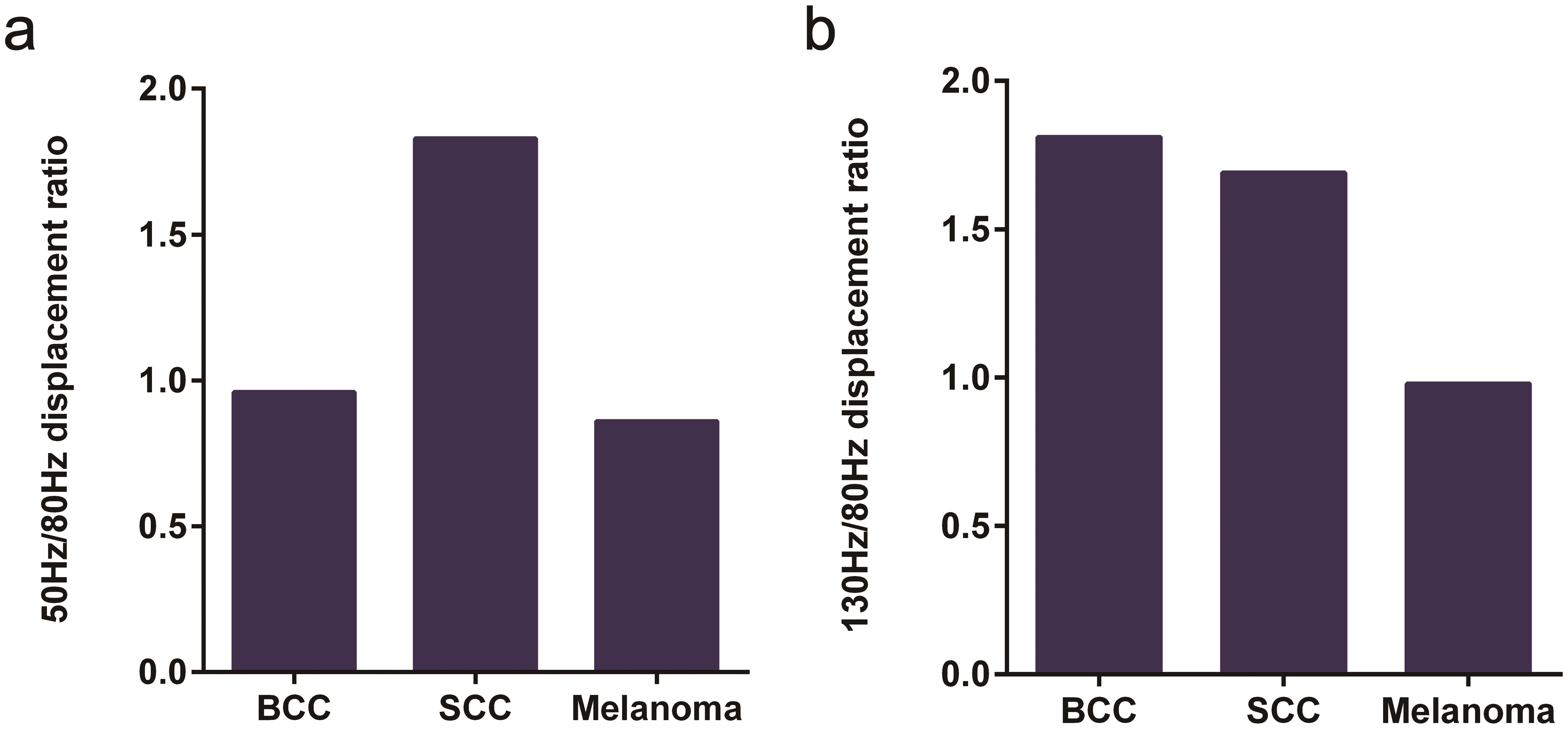 (a) Bar graph showing the 50 Hz/80 Hz ratio peak heights for BCC, SCC, and melanoma. The increased 50 Hz/80 Hz ratio is significantly different for SCC compared to melanoma and BCC, as shown in .