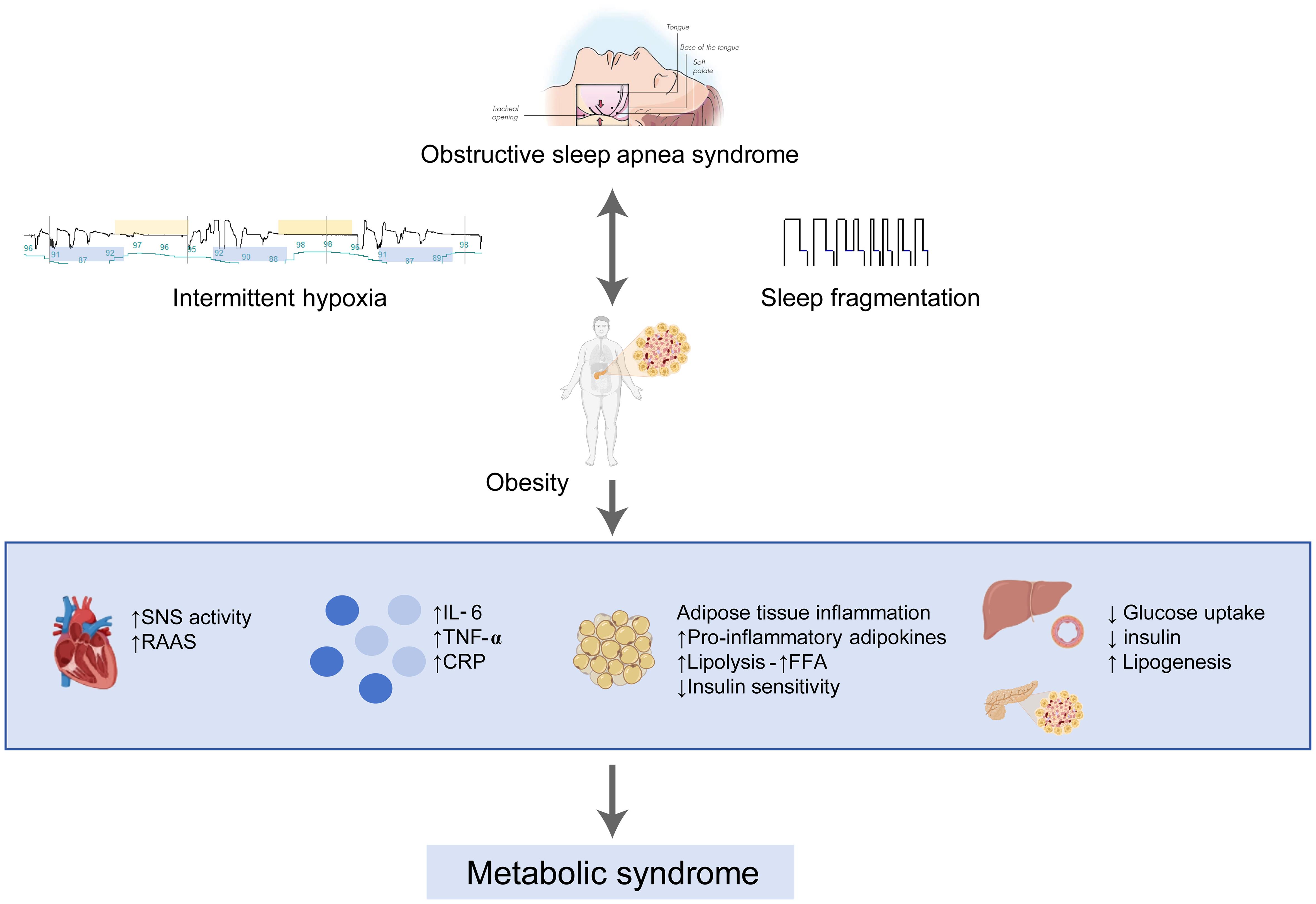 Putative mechanisms connecting obstructive sleep apnea (OSA), obesity, and metabolic syndrome (MetS).