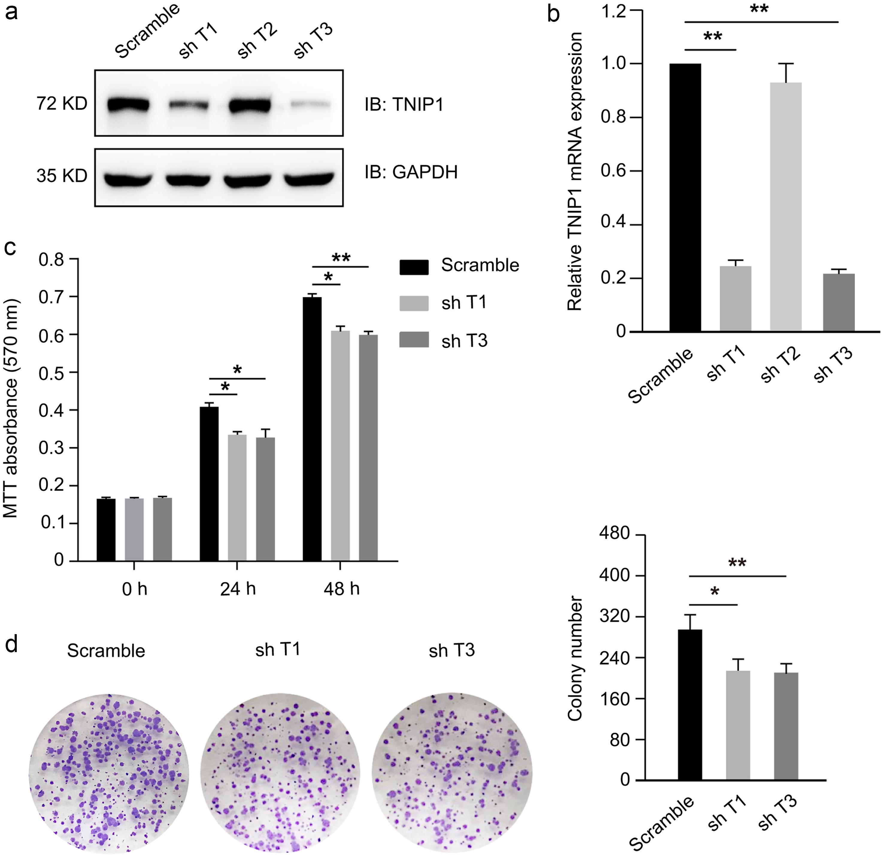 TNIP1 knockdown induced growth arrest in MCF-7 cells.