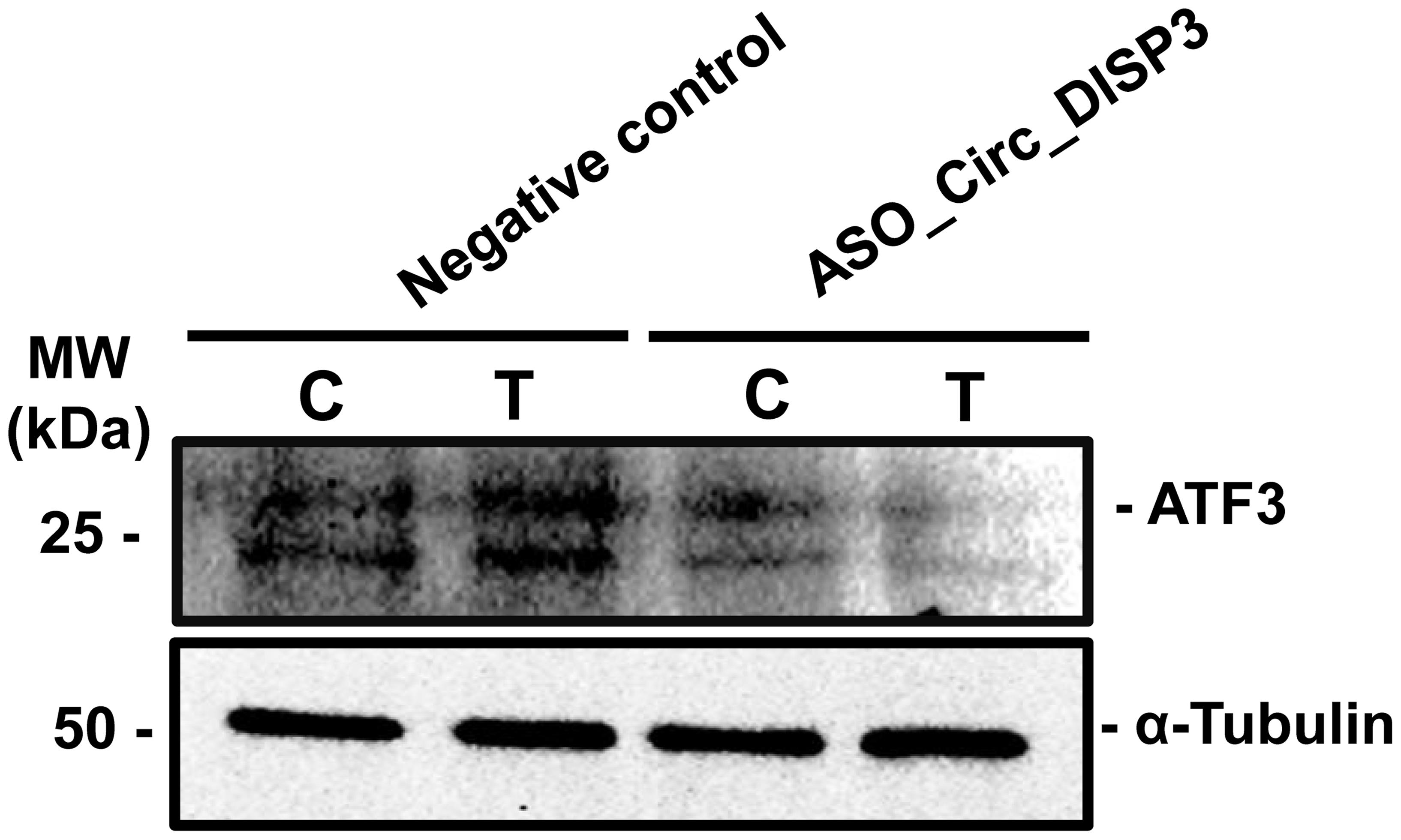 ASO-mediated silencing of circ_DISP3 decreased TGF-β1-stimulated ATF3 expression in hBC cells.