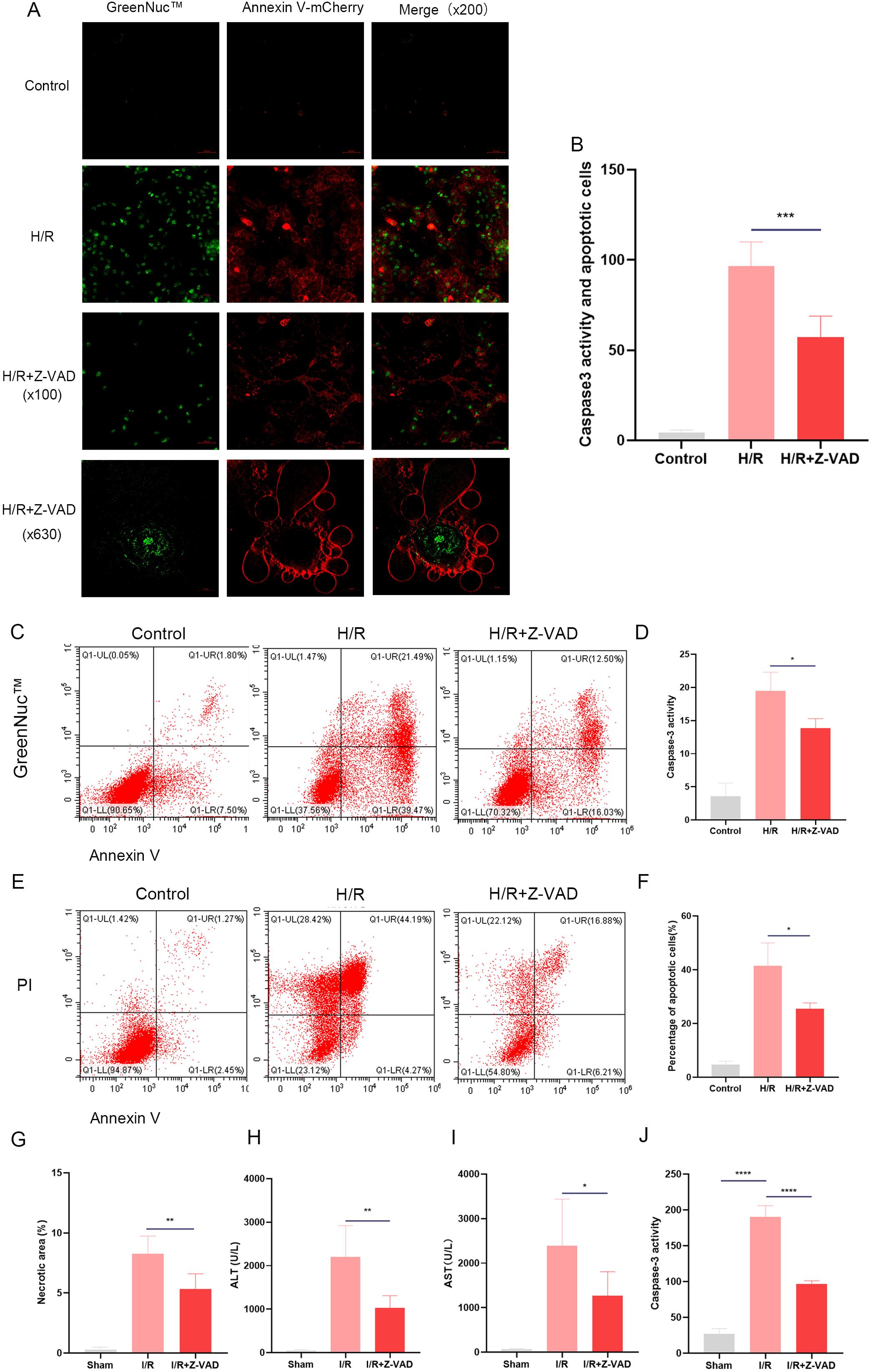 Change of Caspase-3 activity and occurrence of apoptosis during HIRI.