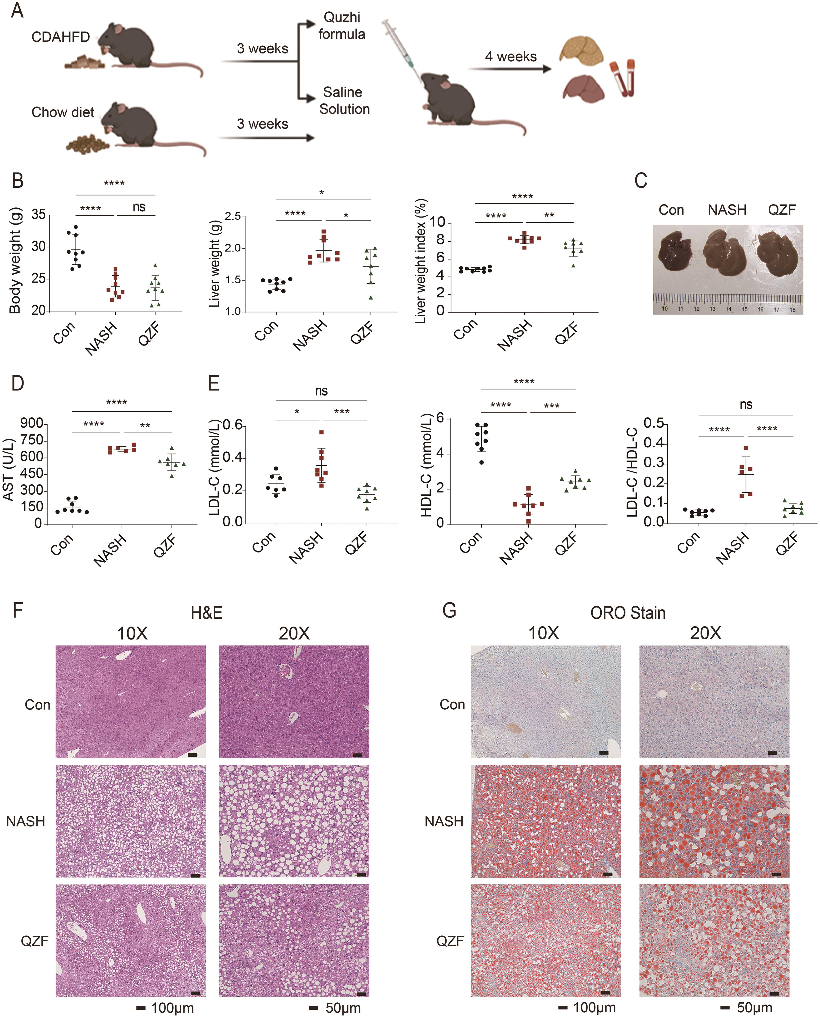 Quzhi formula alleviation of hepatic steatosis in NASH mice.