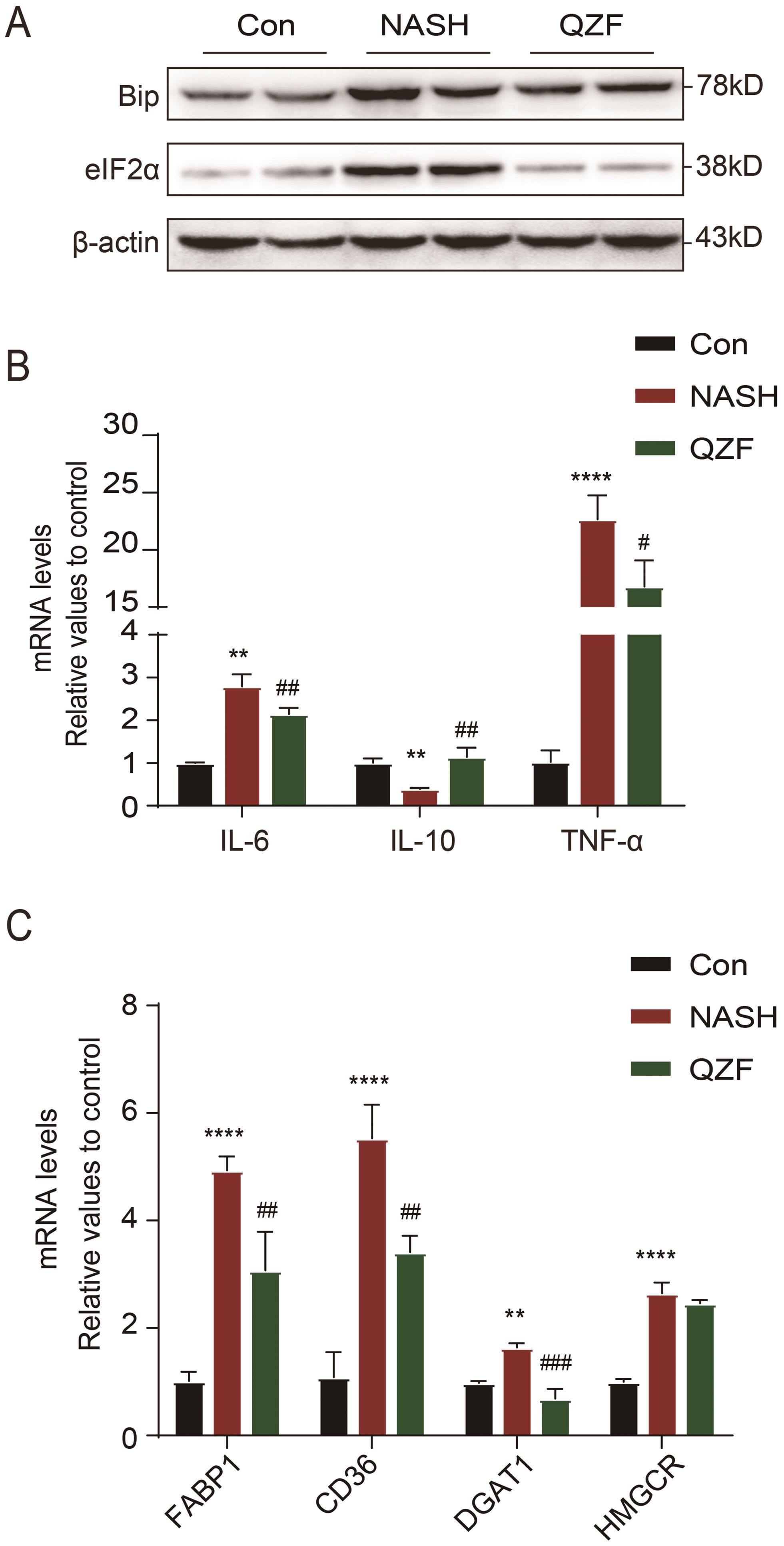 Administration of Quzhi formula inhibits inflammation-related gene expression via Bip/eIF2α signaling, and downregulates lipogenic gene expression in mice fed with CDAHFD.