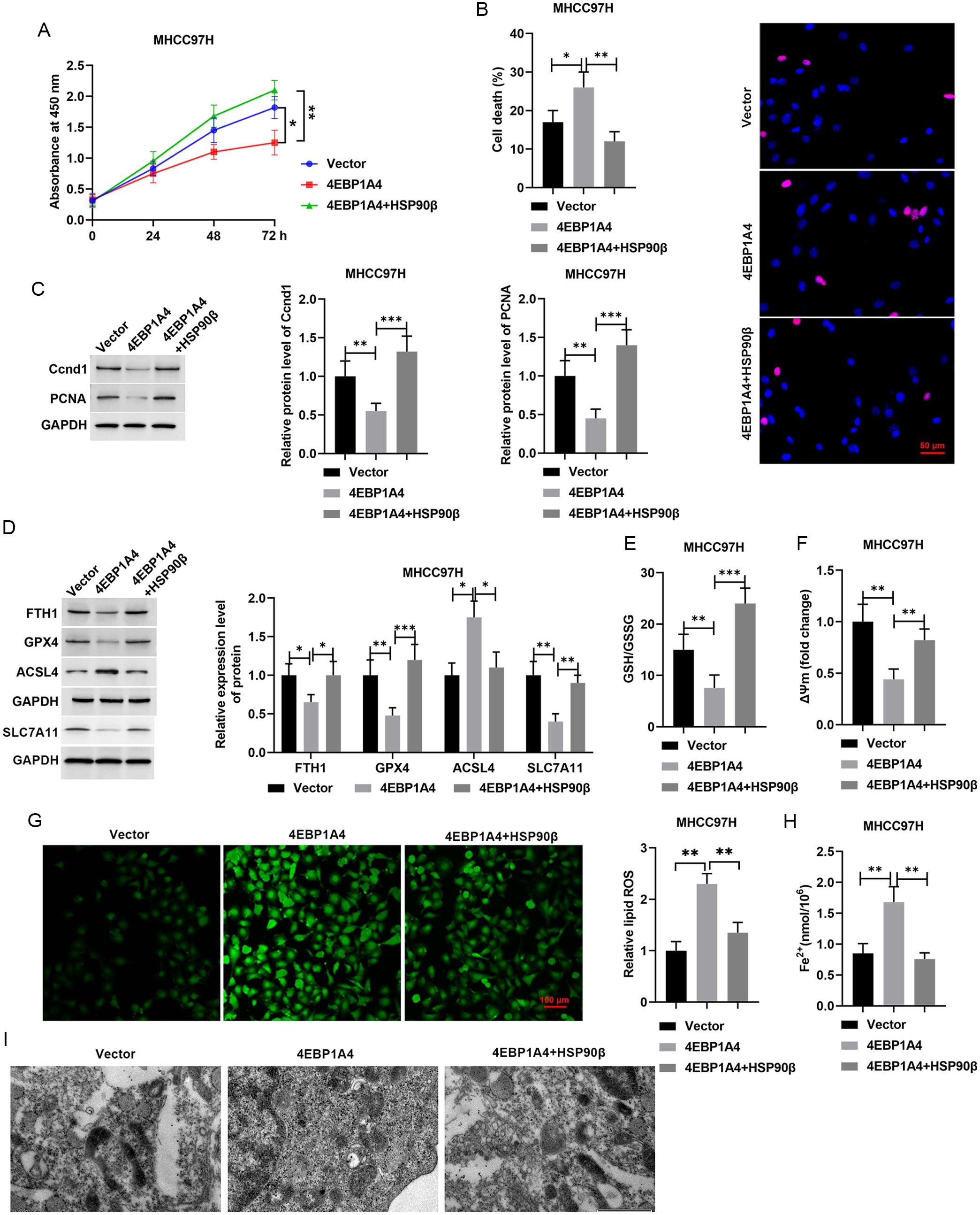 Effects of HSP90β overexpression on 4EBP1A4- mediated ferroptosis in HCC cells.