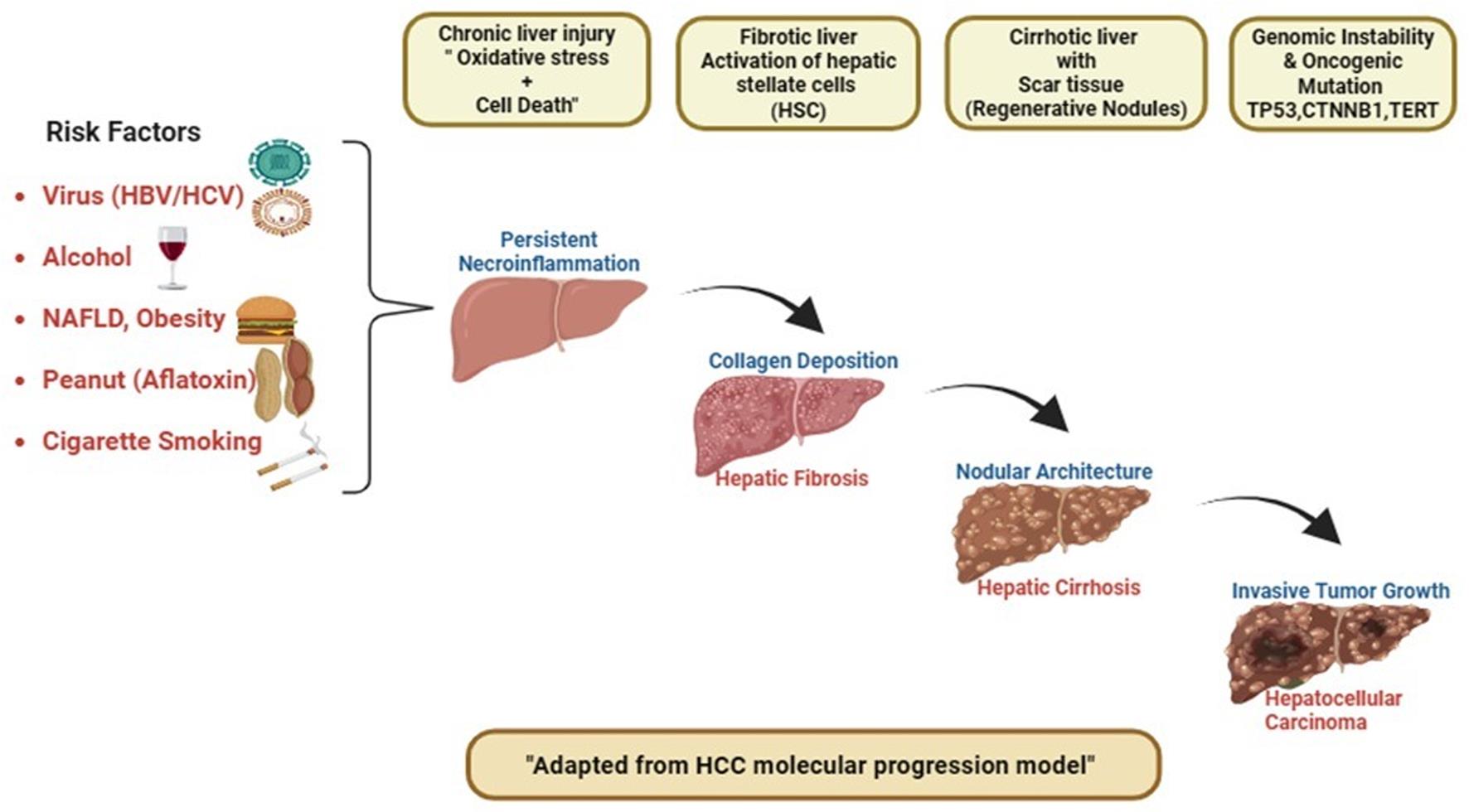 Risk factors and pathogenesis of hepatocellular carcinoma (HCC).