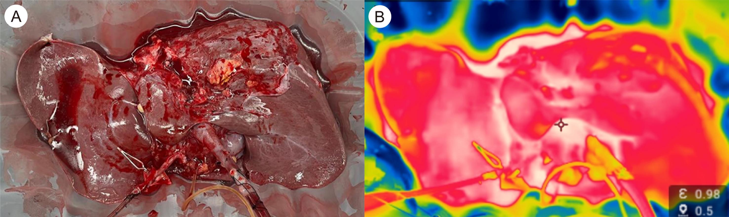 (A) Appearance of the liver and (B) thermal imaging of the liver during perfusion.