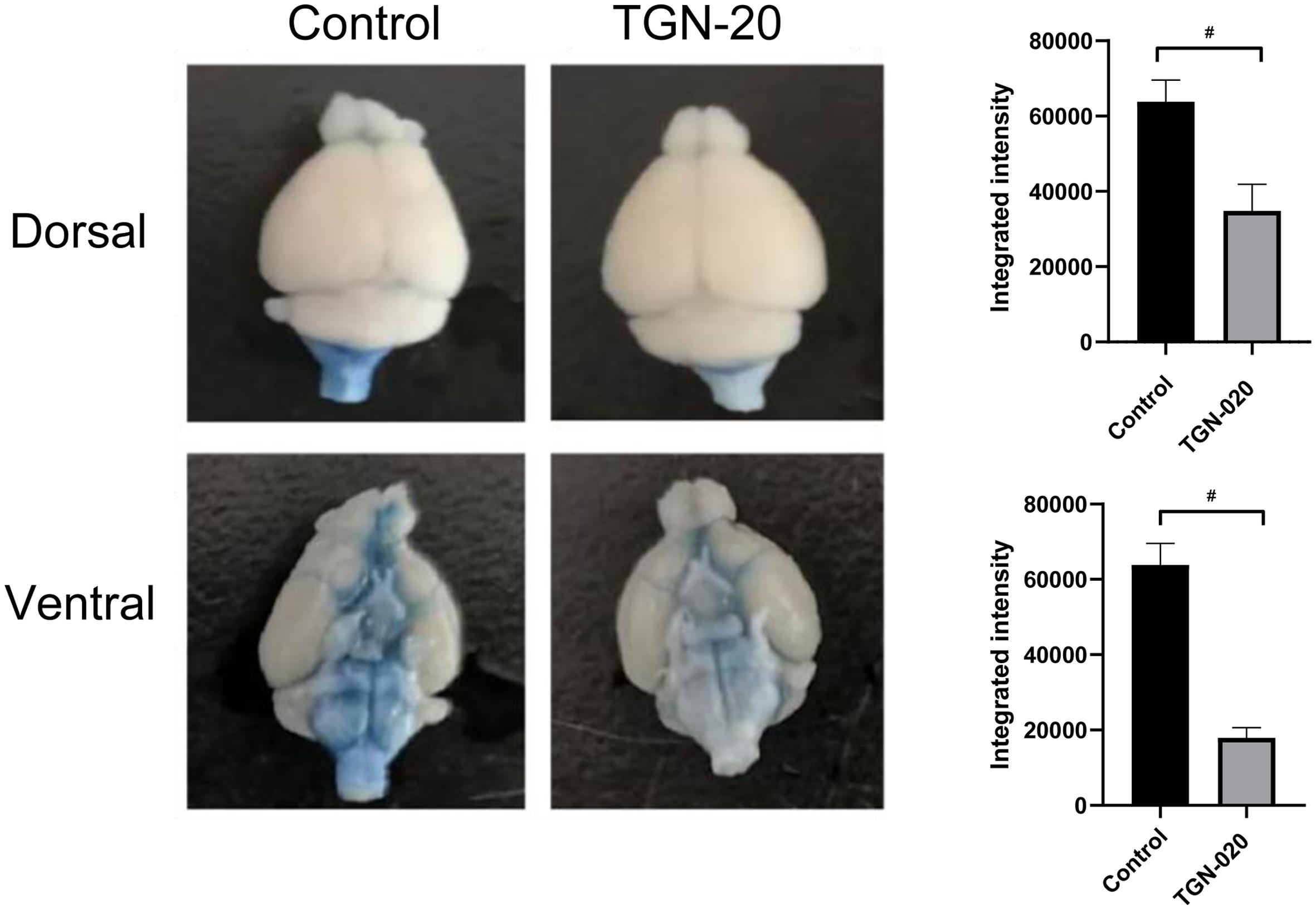 TGN-020 significantly inhibited glymphatic function.