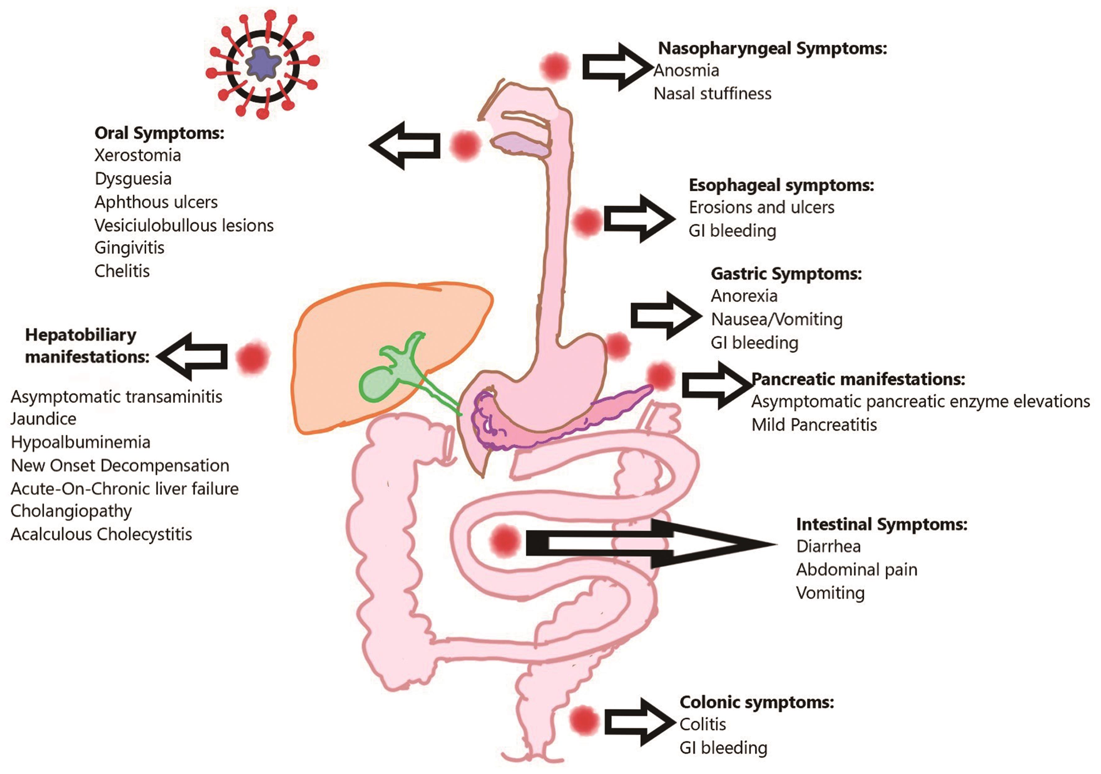 GI and hepatic manifestations of COVID-19.