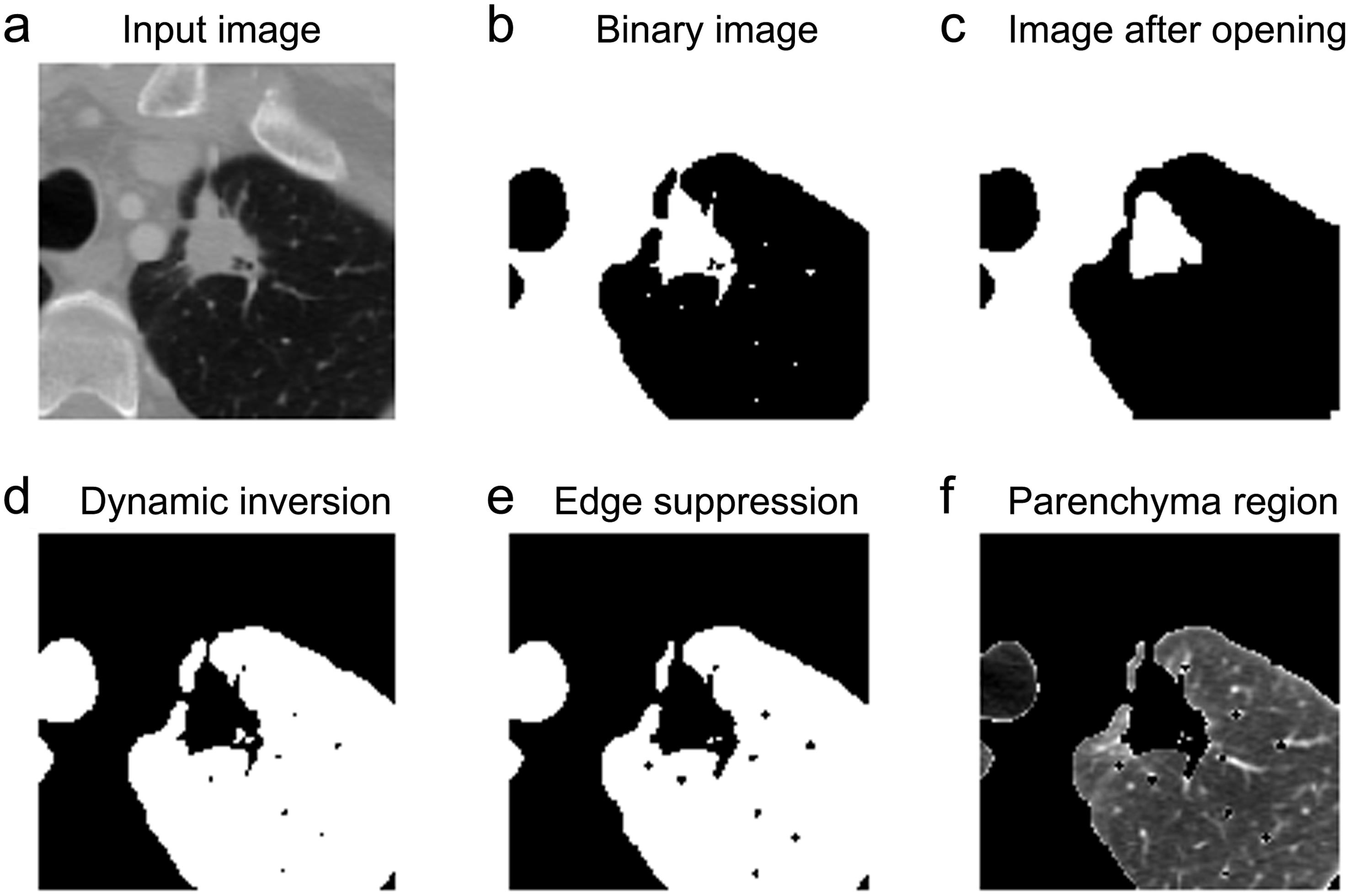 Result of image binarization, morphological opening and binary mask overlay with image.