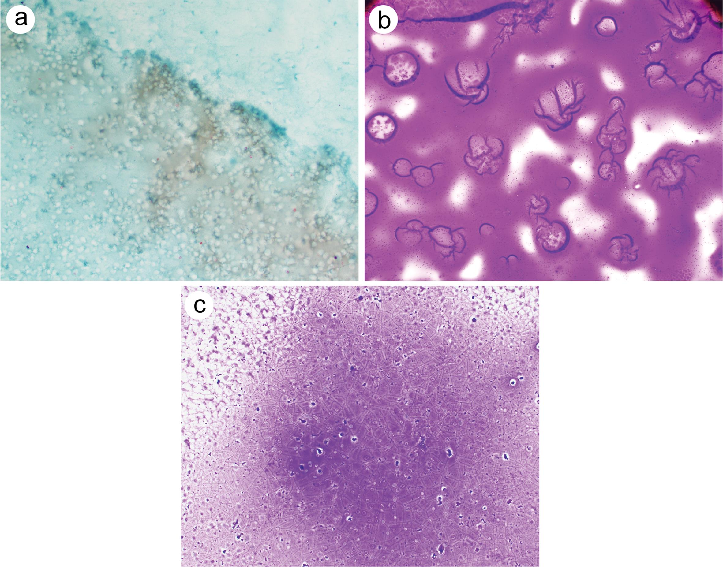 Colloid.