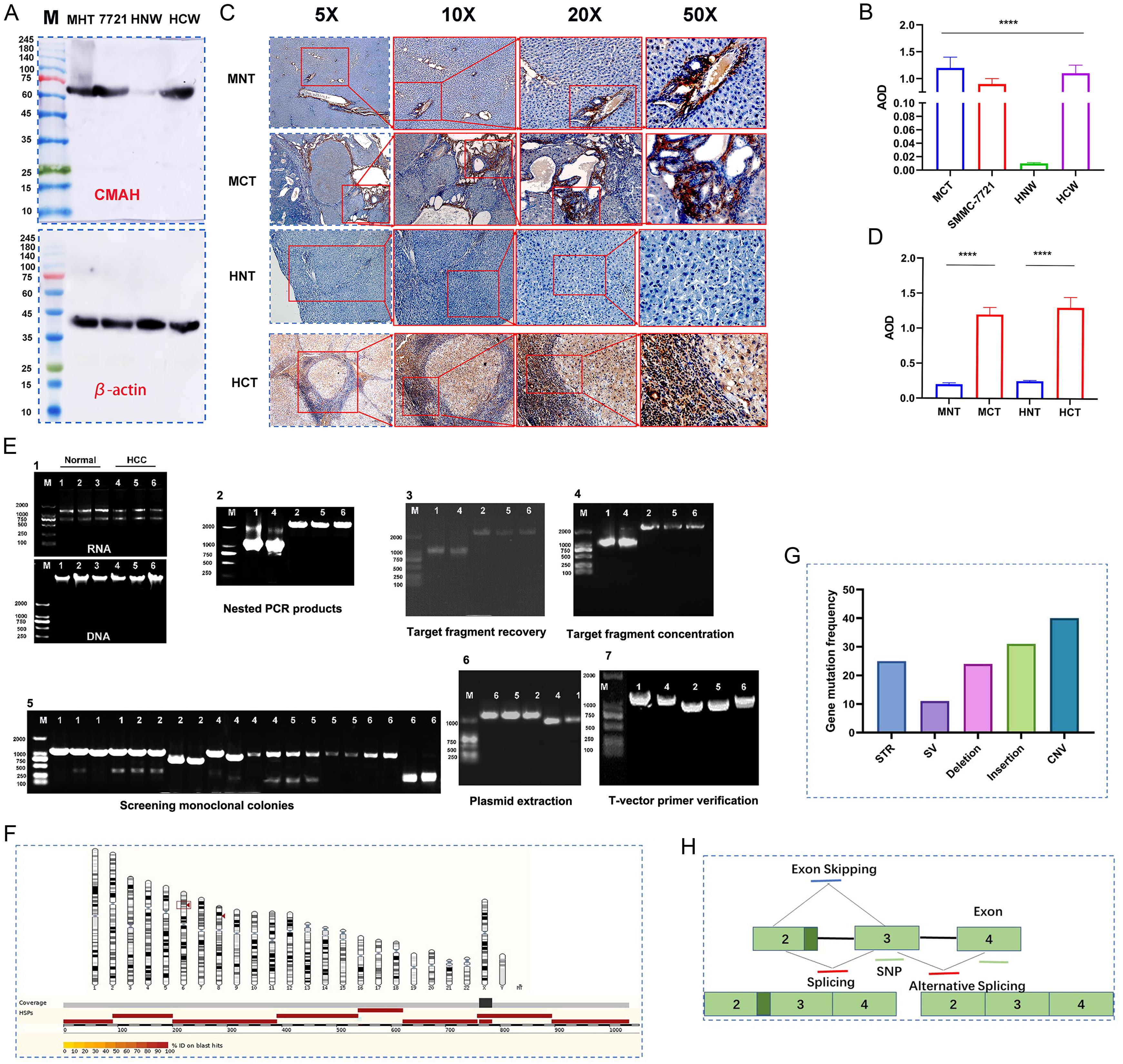 CMAH expression in HCC and sequence analysis of the <italic>CMAH</italic> gene.