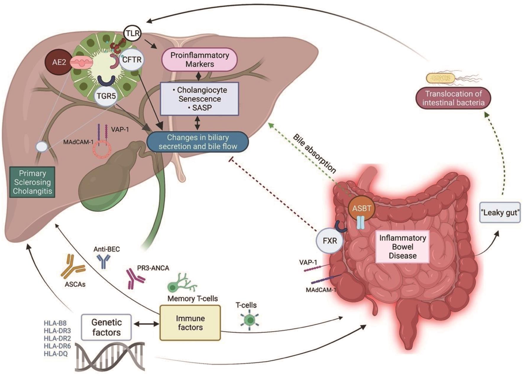 Illustration of potential pathogenic factors of PSC-IBD.
