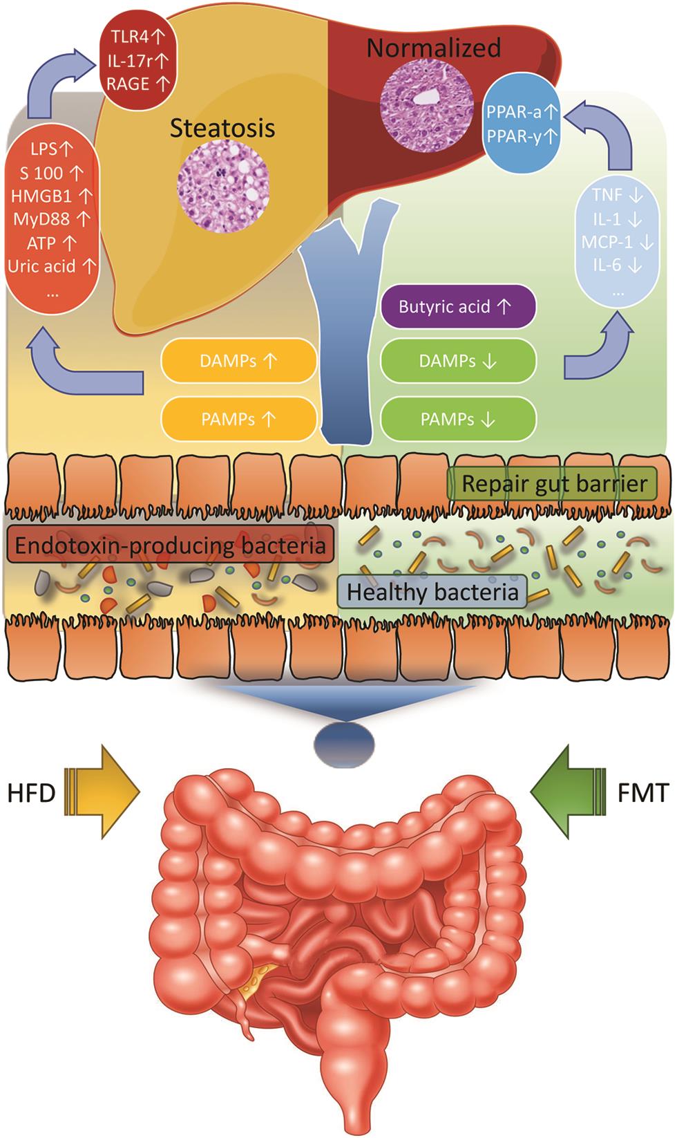 Proposed molecular mechanism of FMT for the treatment of NAFLD.
