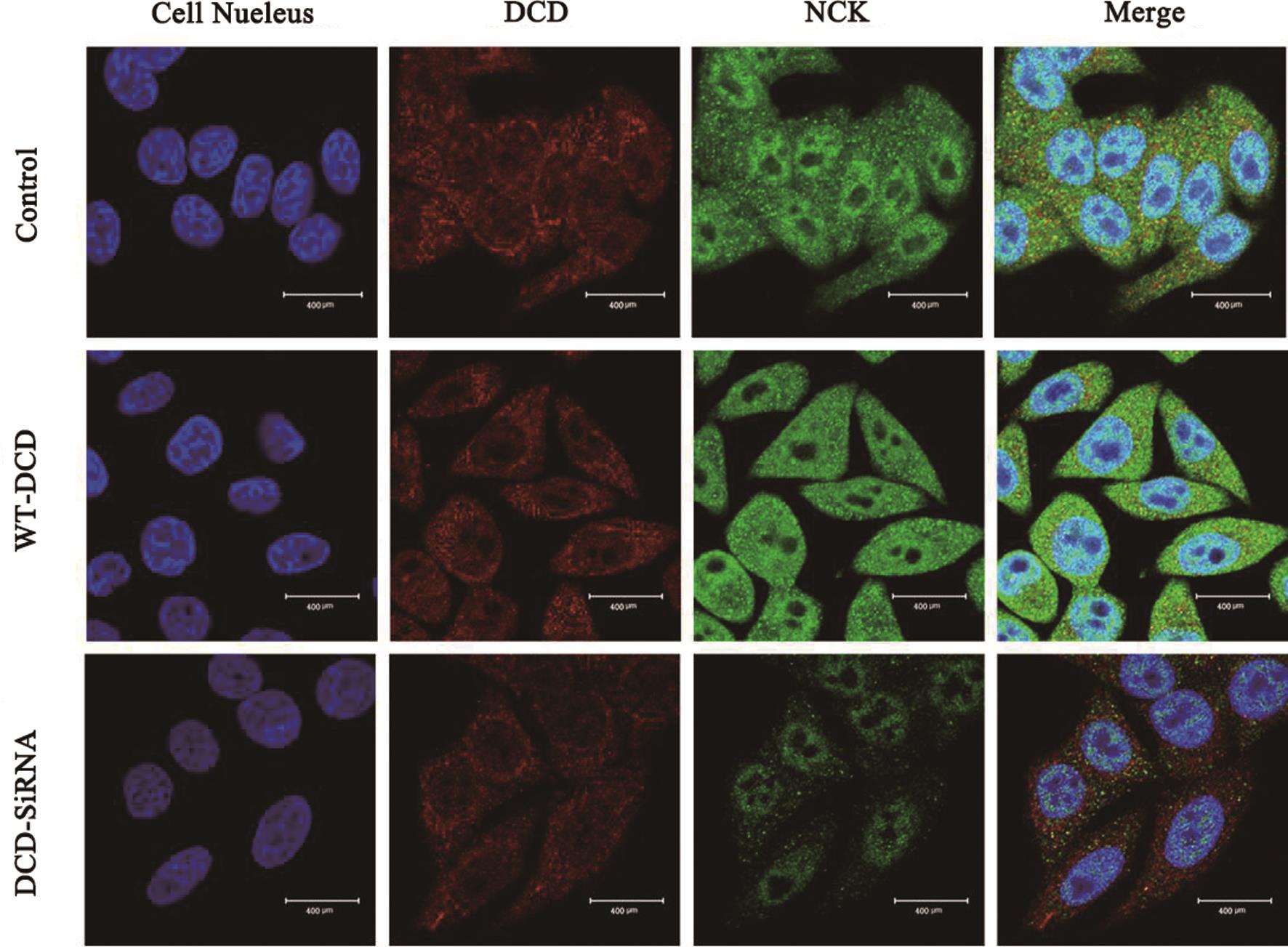 Colocalization of DCD and NCK proteins in SK-HEP-1 cells.
