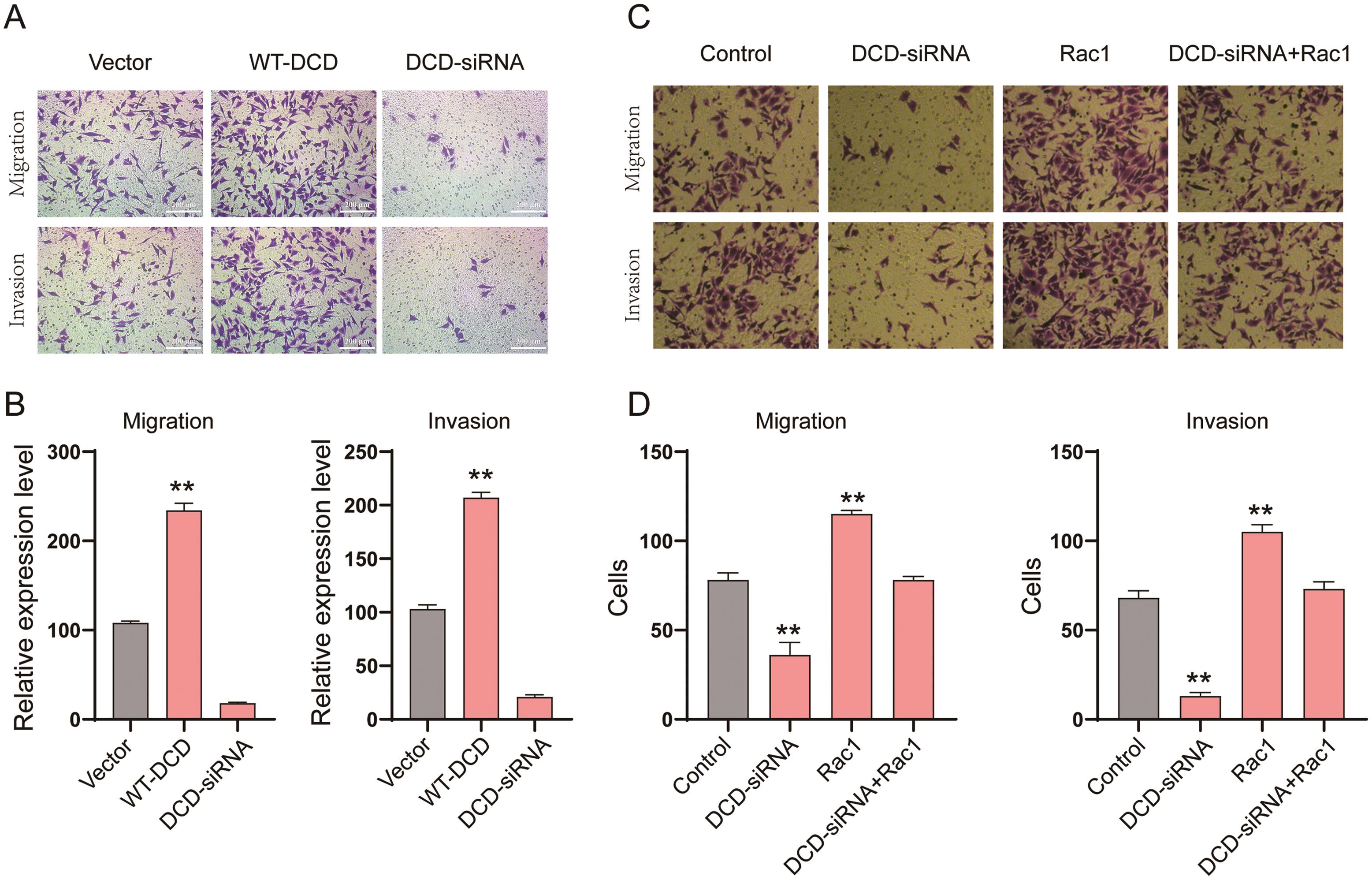 Effects of DCD on HCC cell migration and invasion and attenuation of the <italic>DCD</italic>-siRNA-mediated suppression of SK-HEP1 cell migration and invasion.