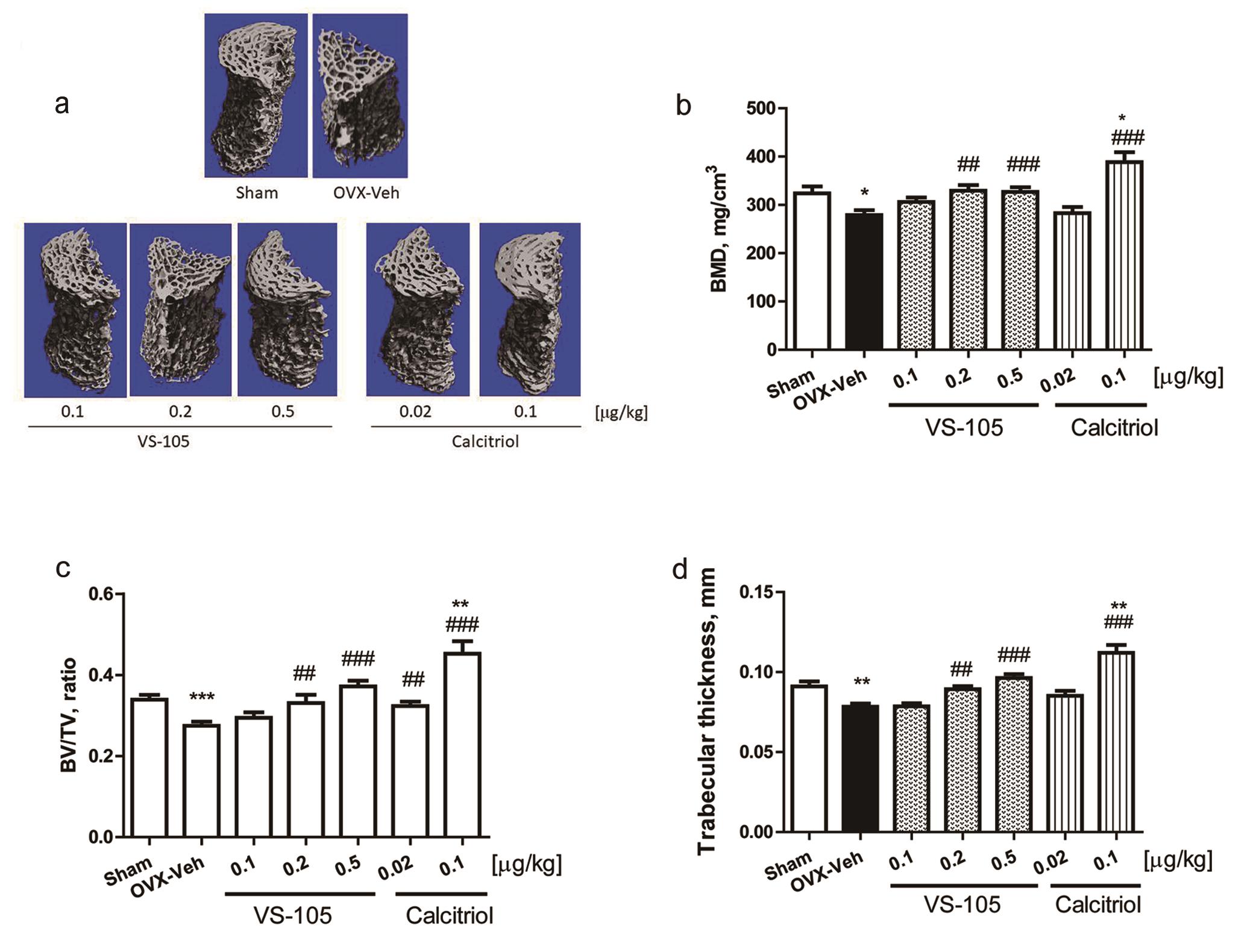 Effects of VS-105 and calcitriol on L3 lumbar vertebra parameters in OVX rats.