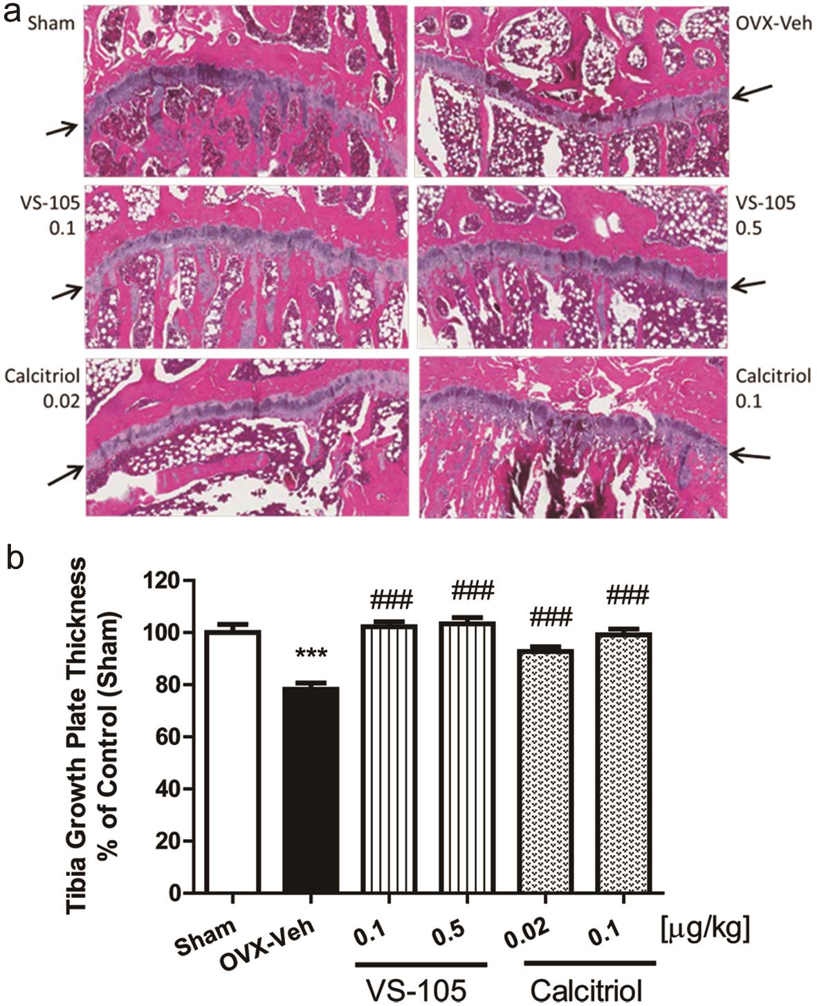 Effects of VS-105 and calcitriol on tibia growth plate thickness in OVX rats.