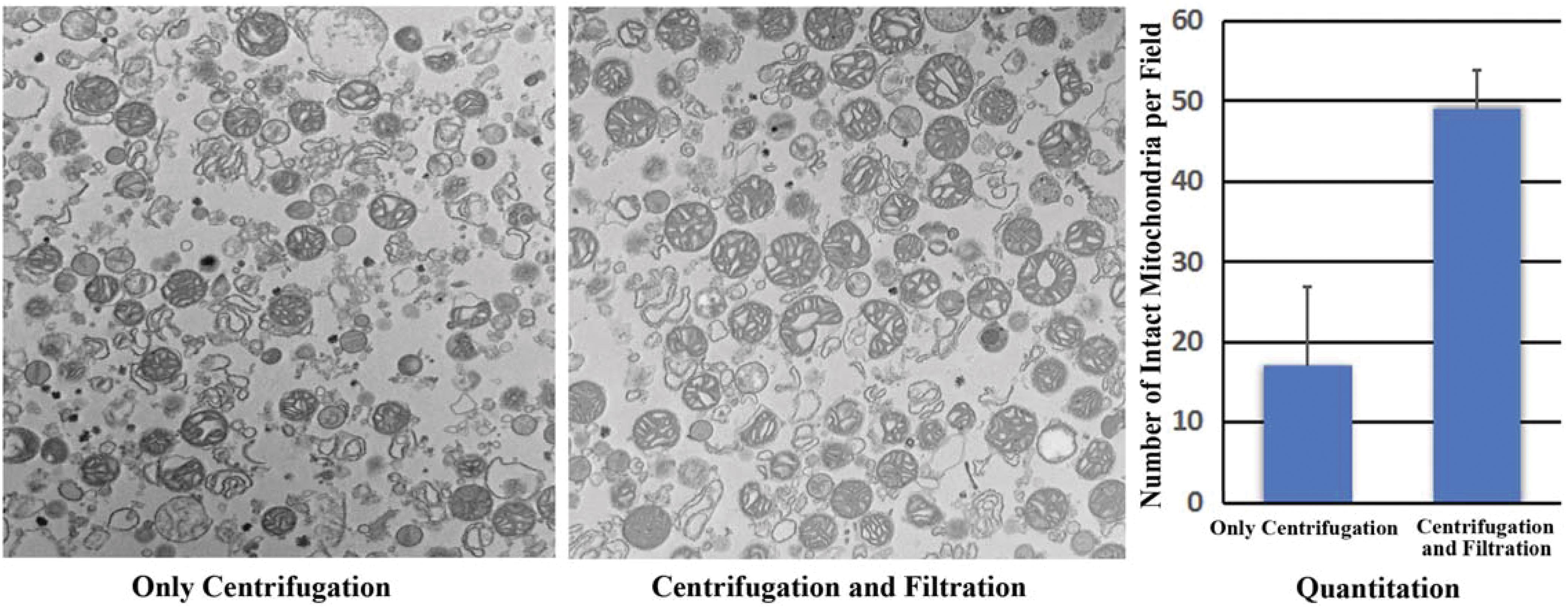 Quantitative effects of filtration on purity of mitochondrial preparation purity.