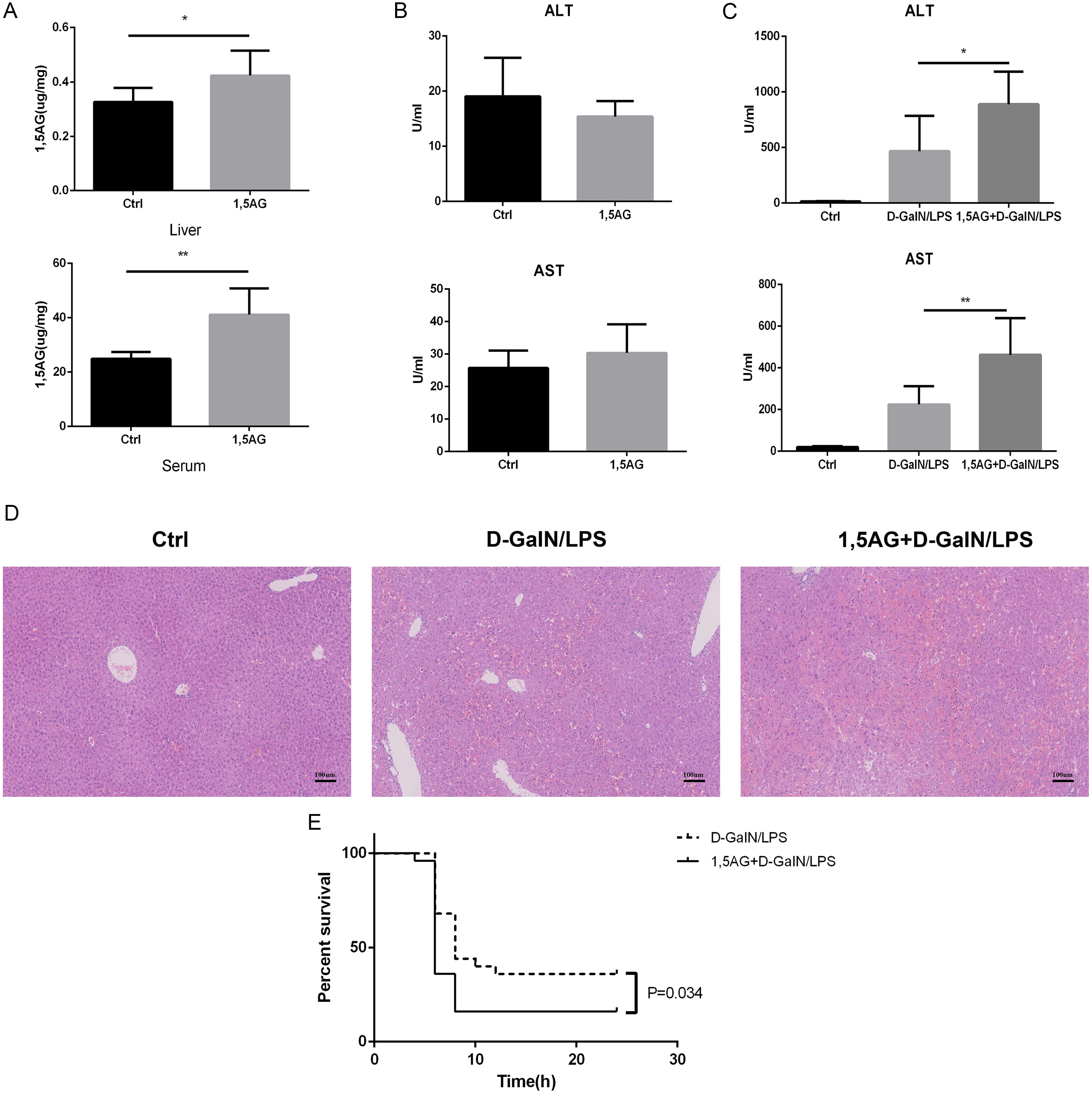 Effects of 1,5AG in LPS/D-GalN-induced ALF mice.