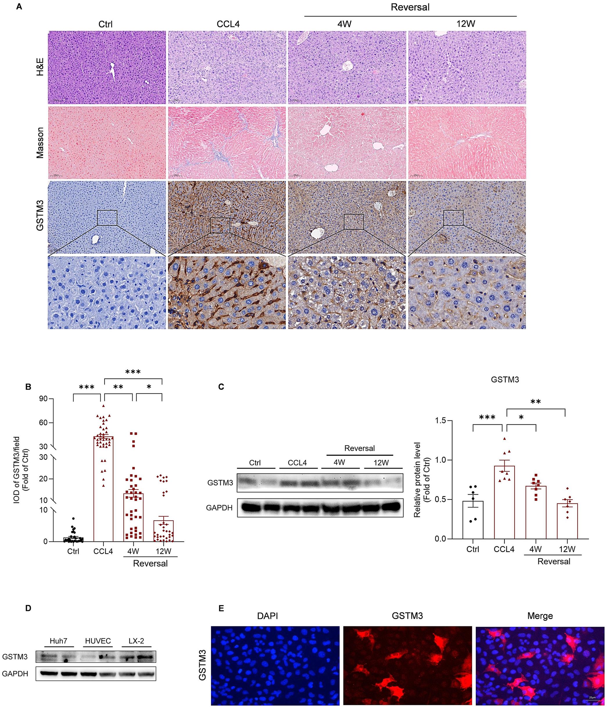 Protein levels and localization of GSTM3 in mouse liver tissues and LX-2 cells.
