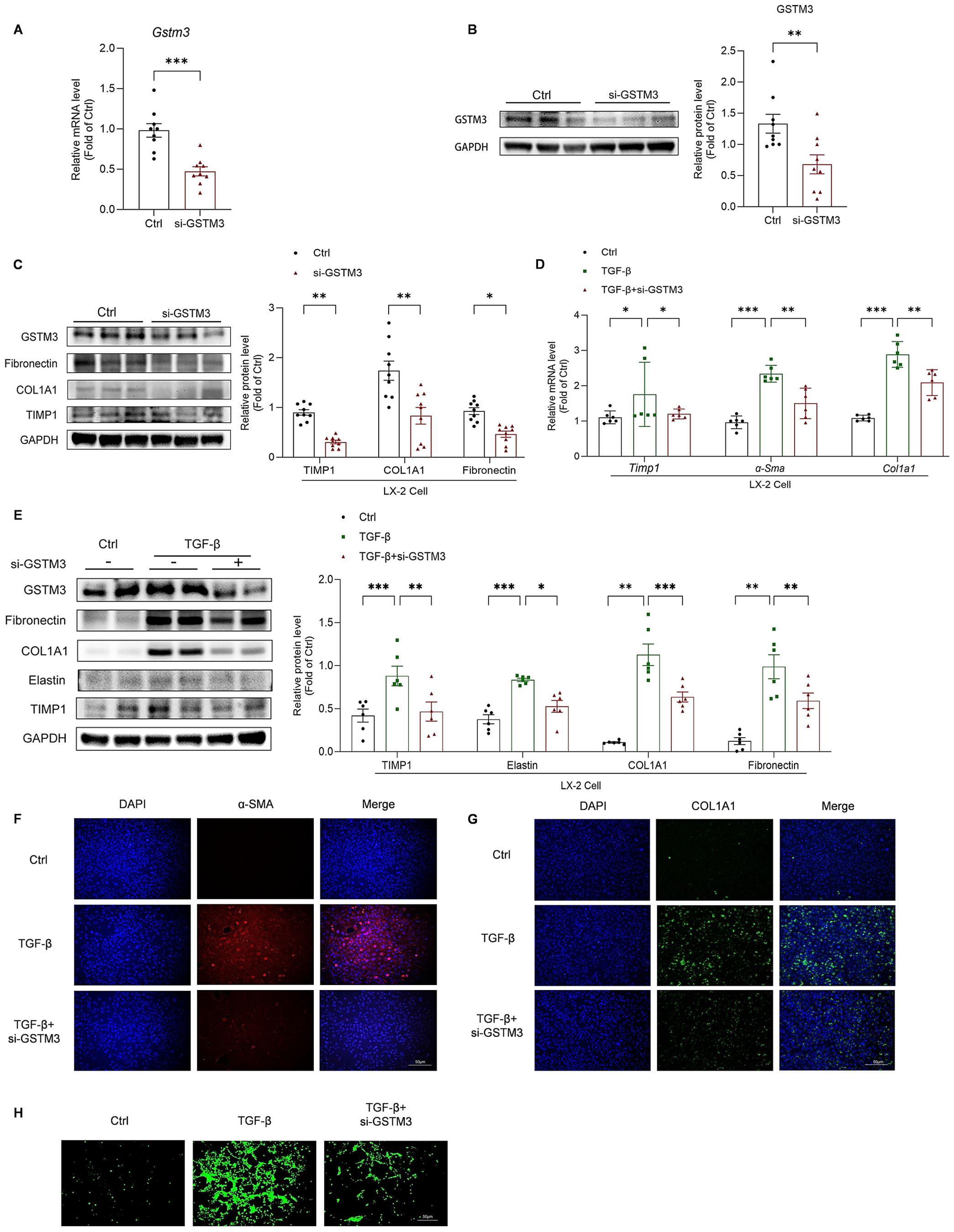 Effects of GSTM3 knockdown on HSC activation and ROS levels in LX-2 cells.