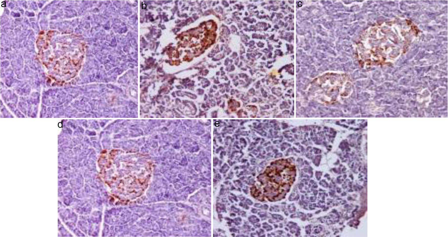 Immunohistochemistry of pancreas (glucagon stain).